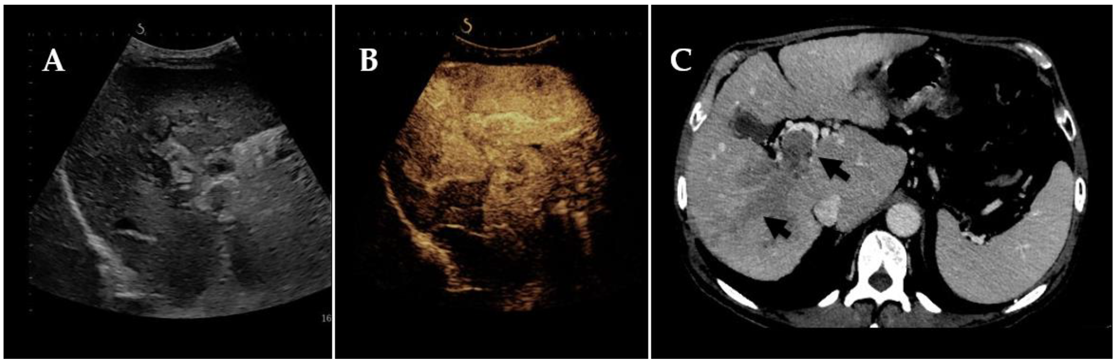 Tomography 09 00154 g001