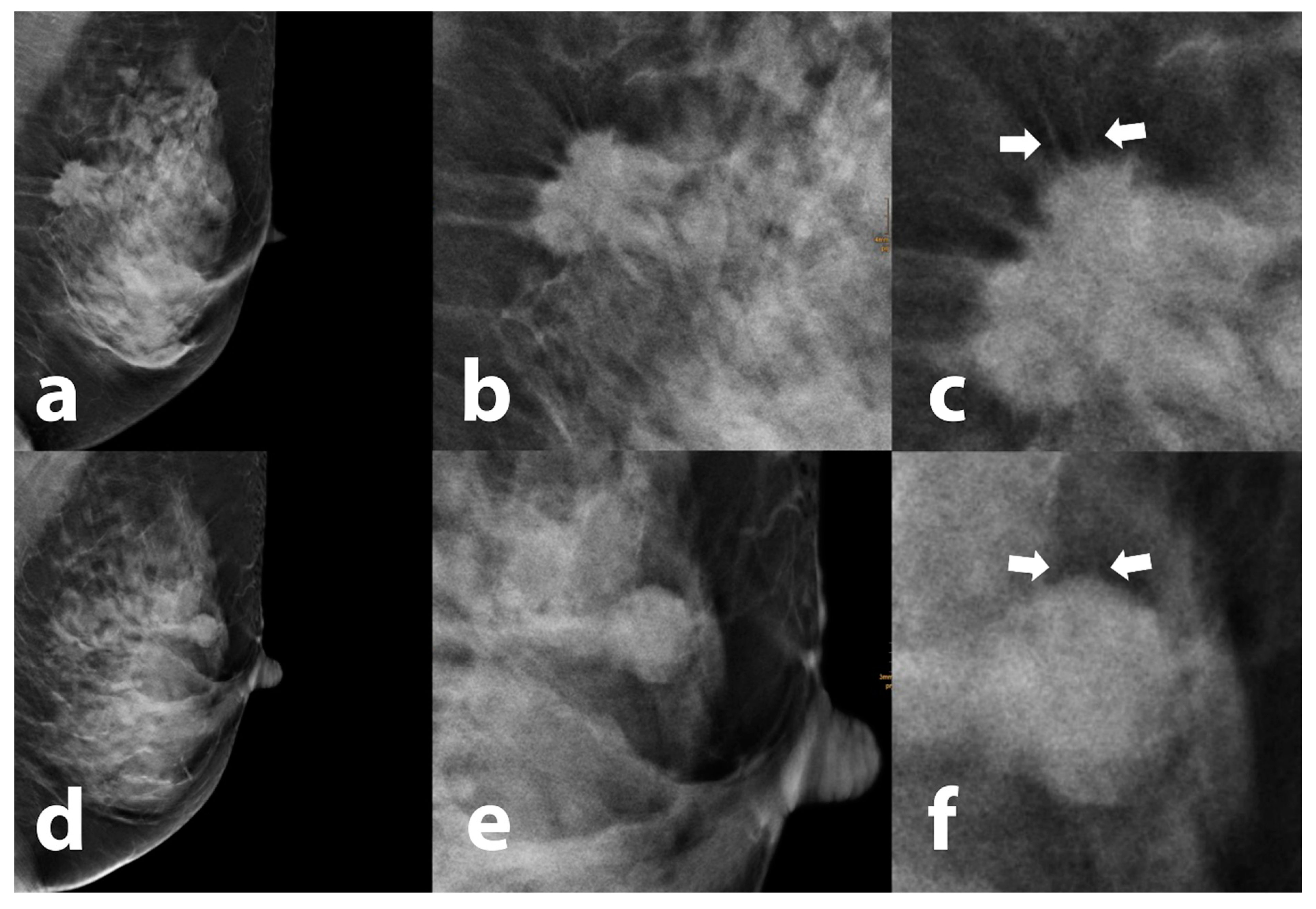 Tomography 09 00155 g001