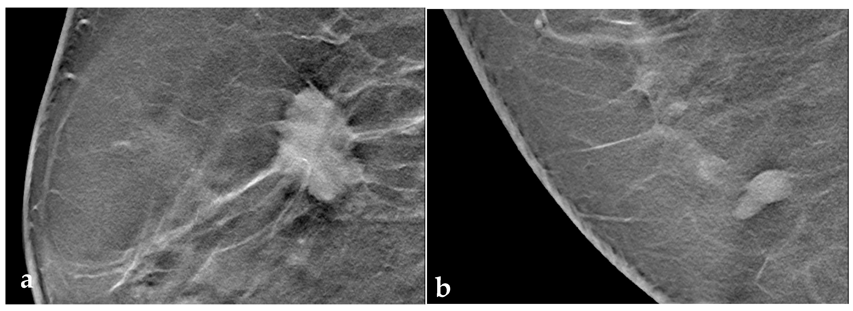 Tomography 09 00155 g002