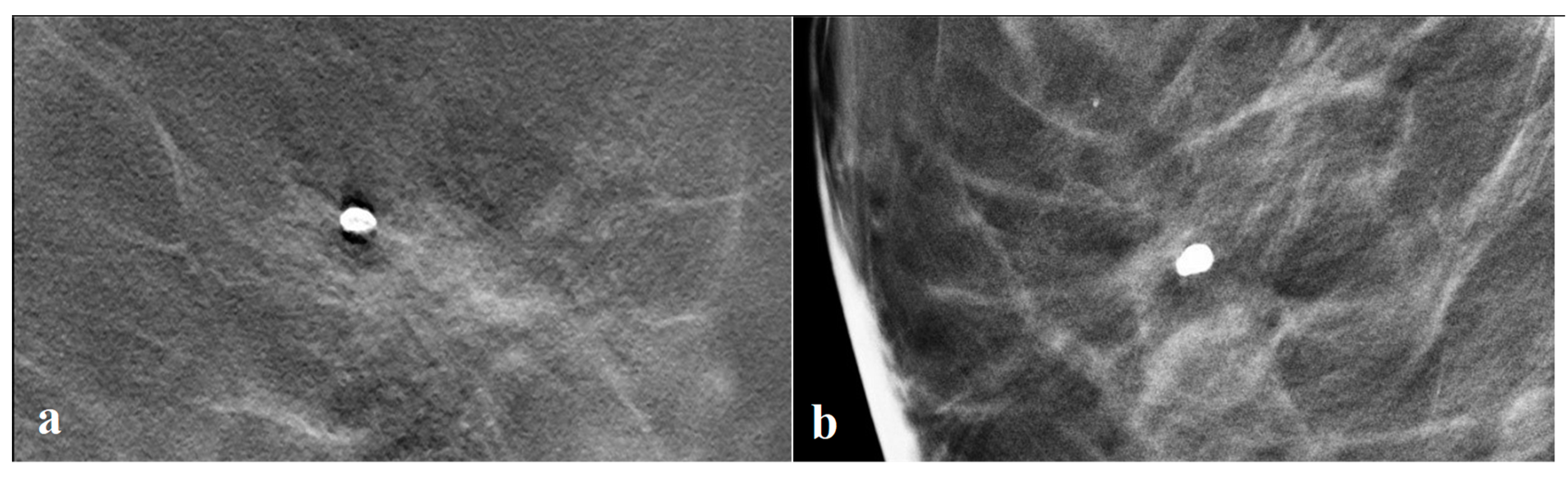 Tomography 09 00155 g005