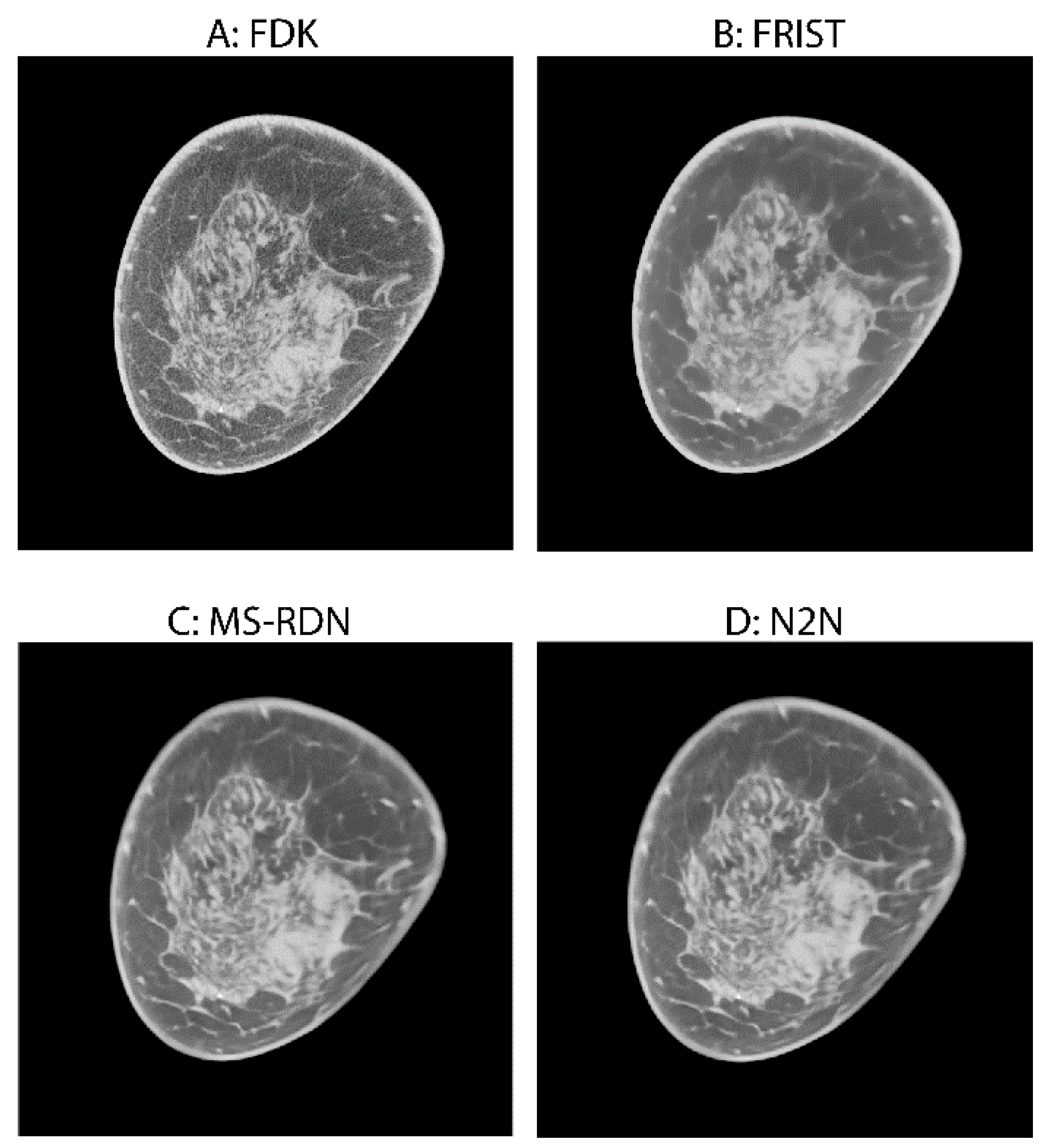 Tomography 09 00160 g002 Tomography 09 00160 g002
