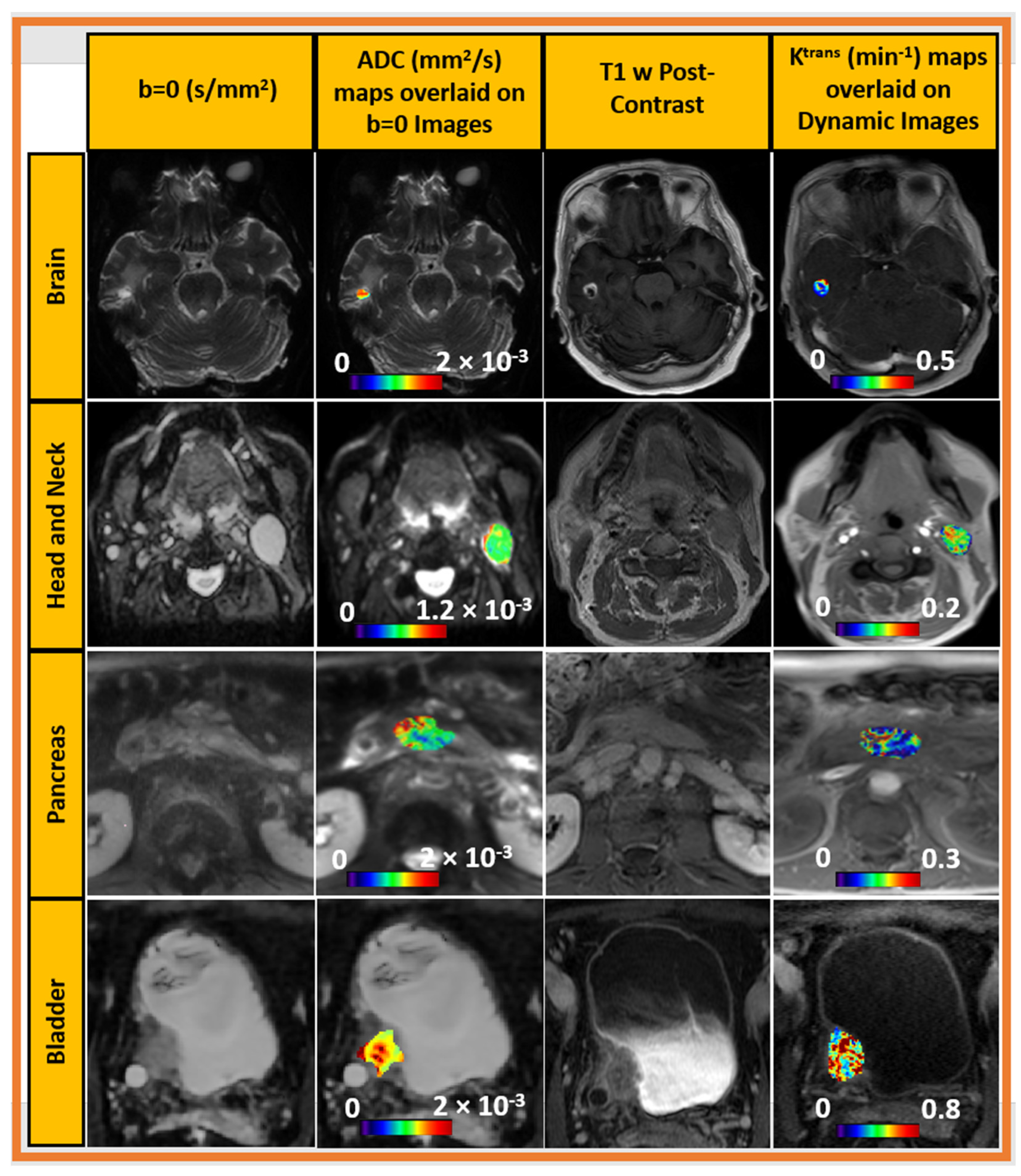 Tomography 09 00161 g003