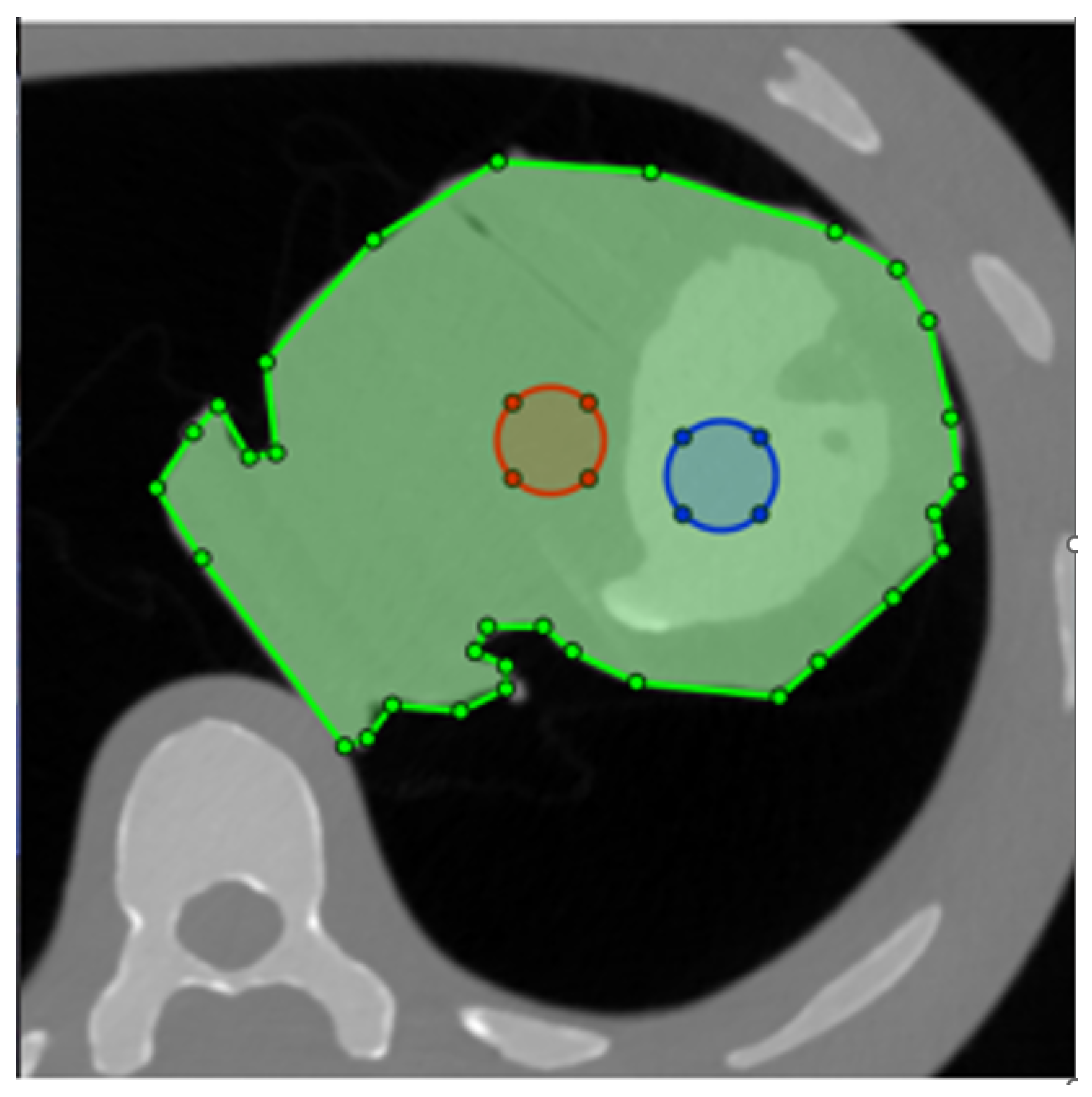 Tomography 09 00164 g002