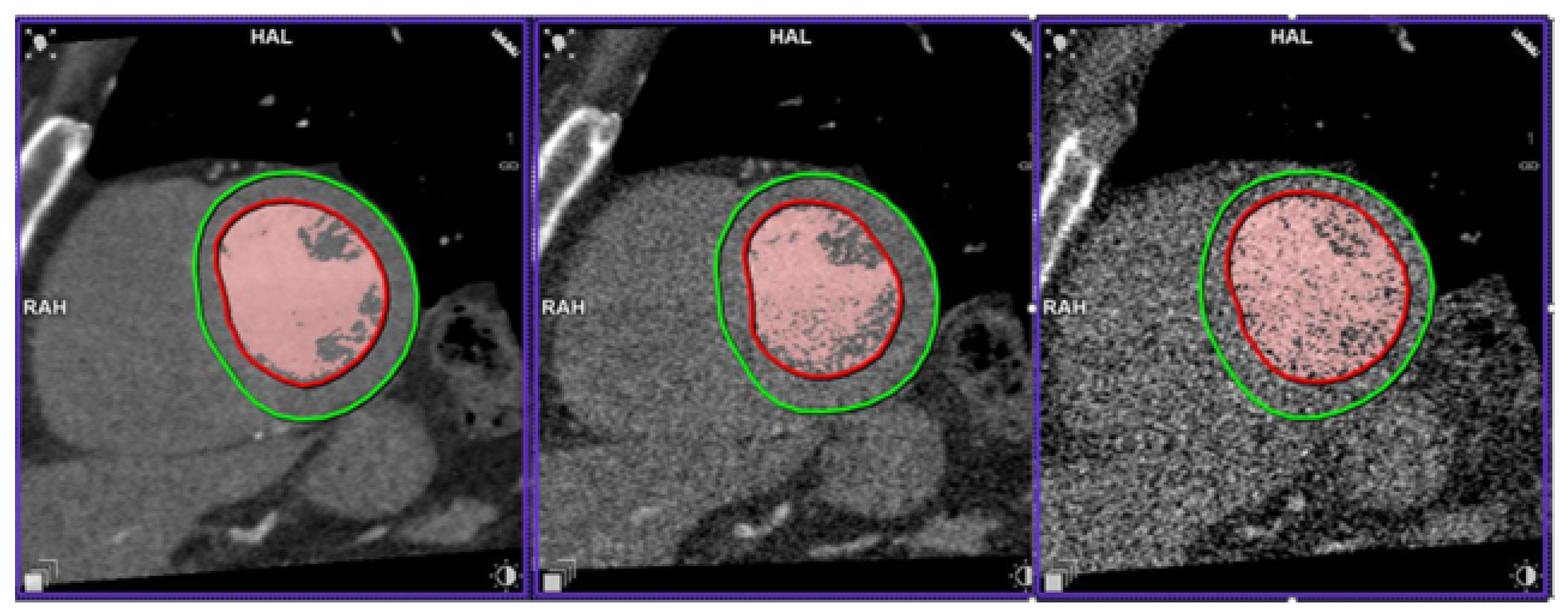 Tomography 09 00164 g006