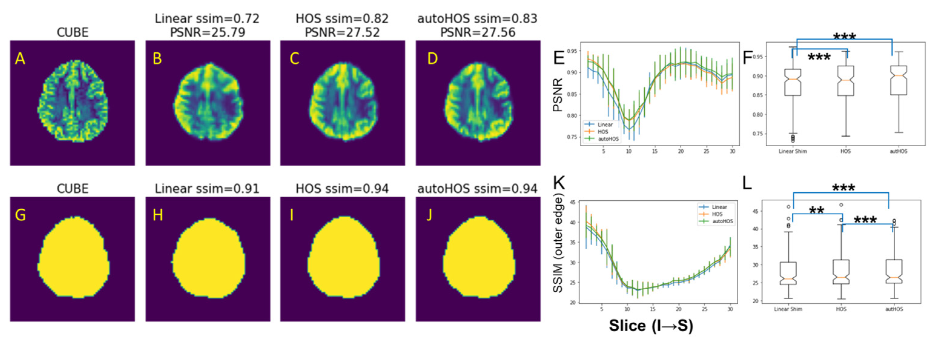 Tomography 09 00168 g003