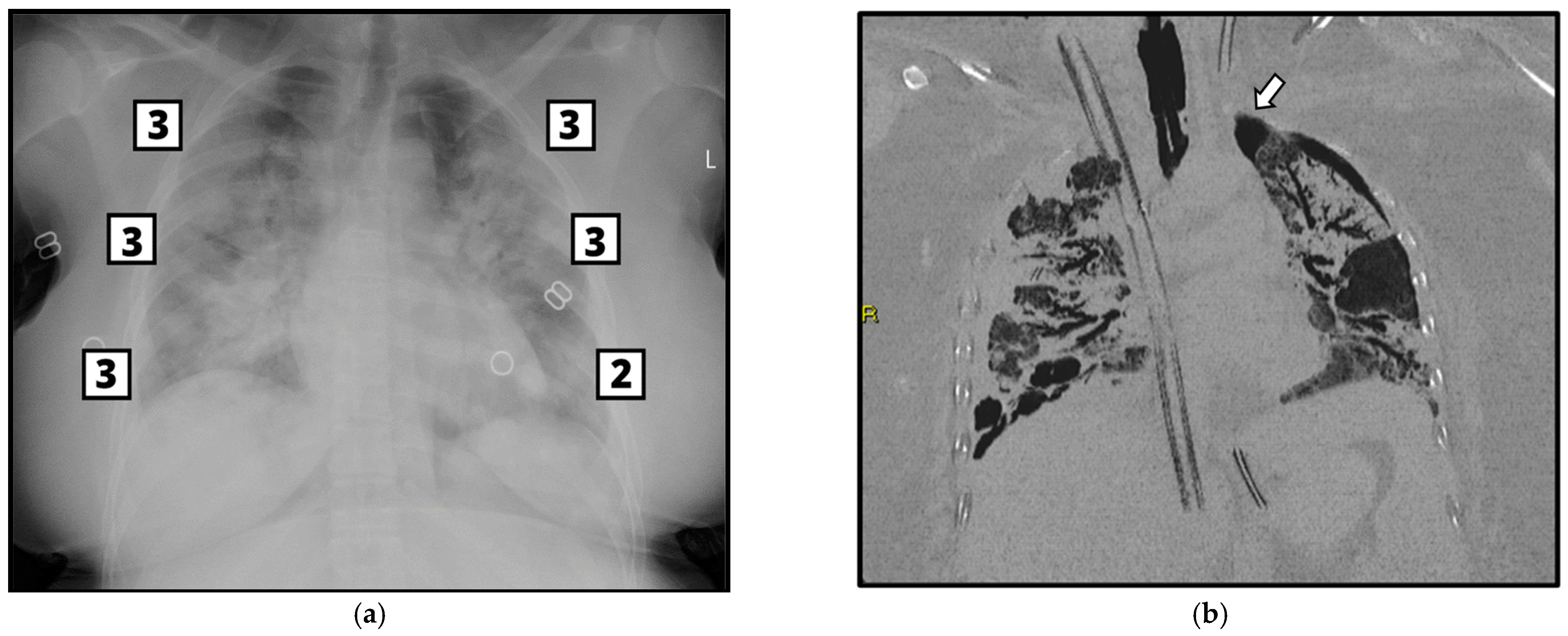 Tomography 09 00171 g004