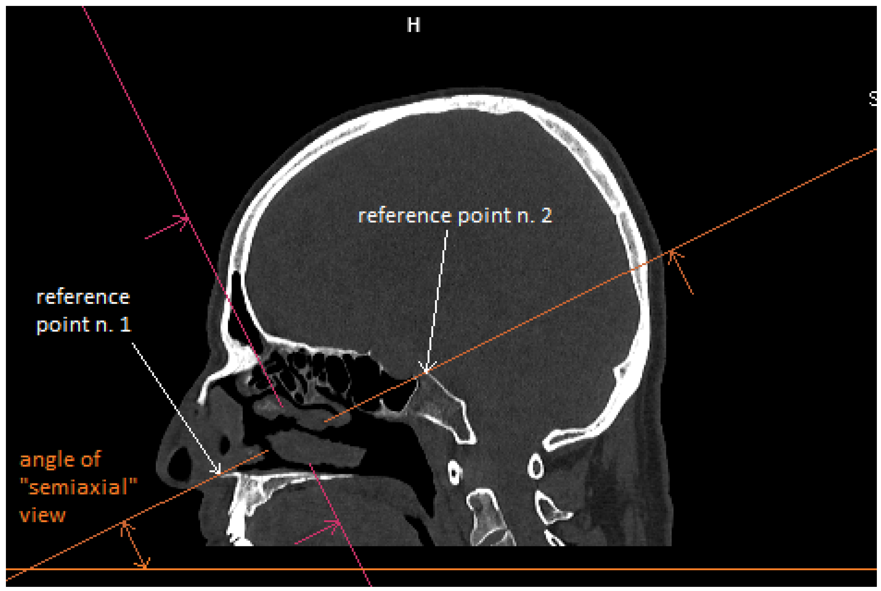Tomography 09 00172 g001