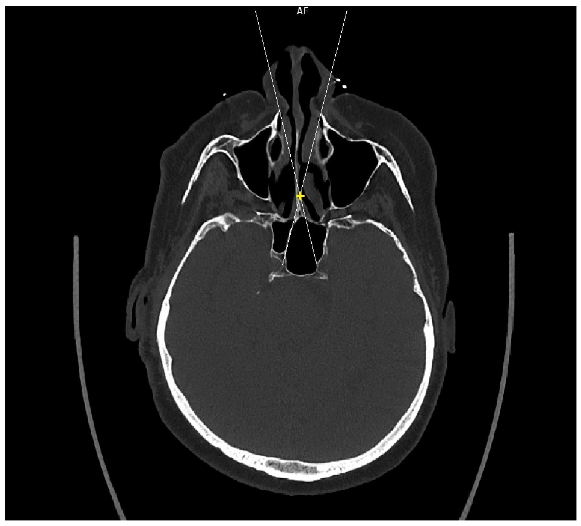 Tomography 09 00172 g002
