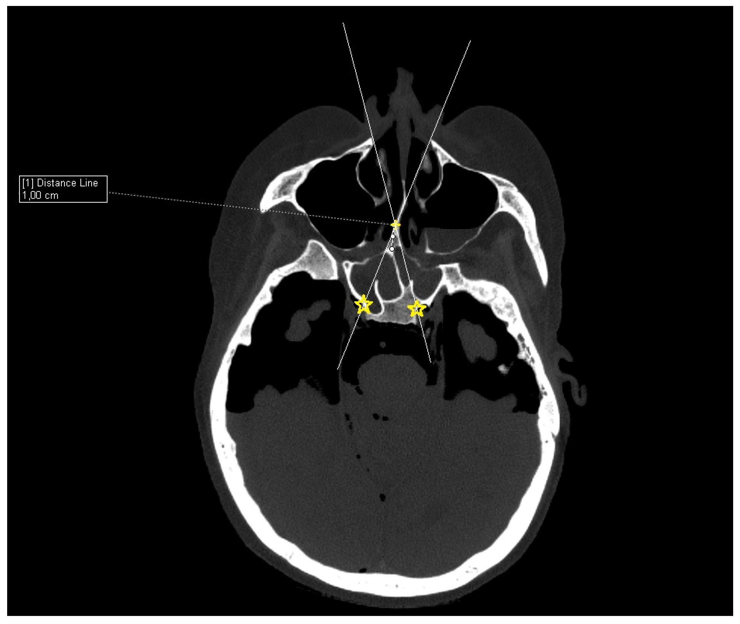 Tomography 09 00172 g003