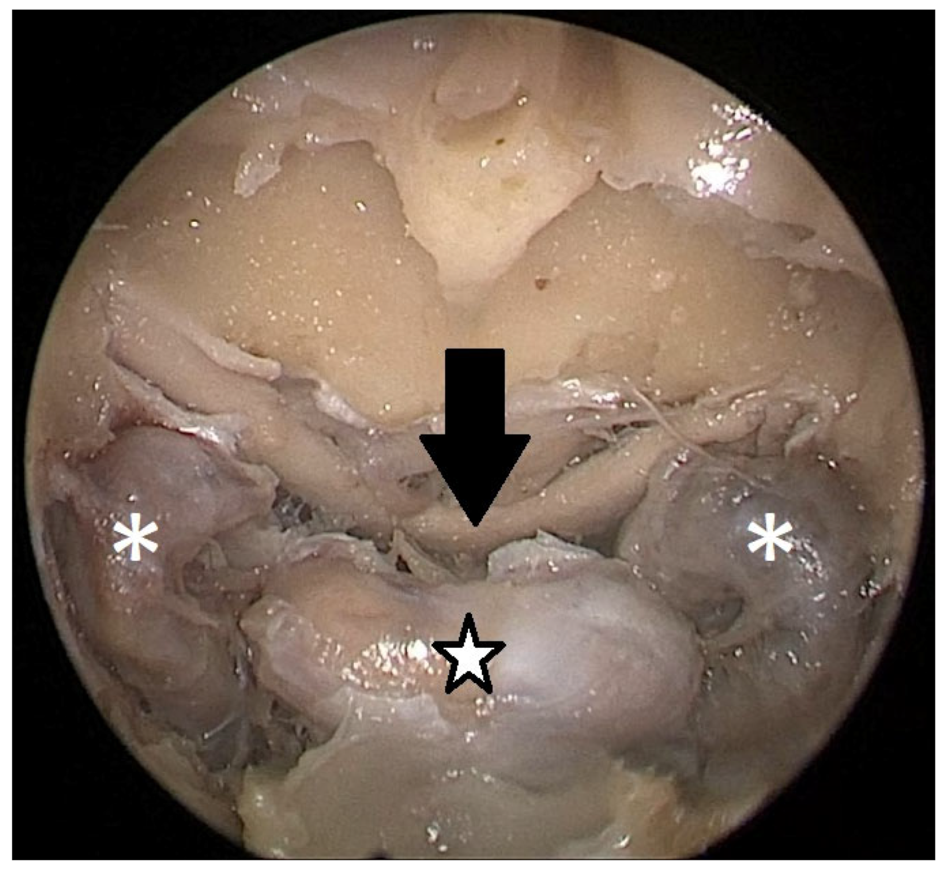 Tomography 09 00172 g004