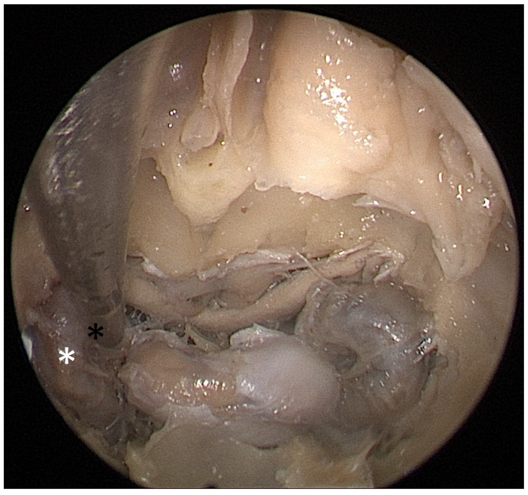 Tomography 09 00172 g005