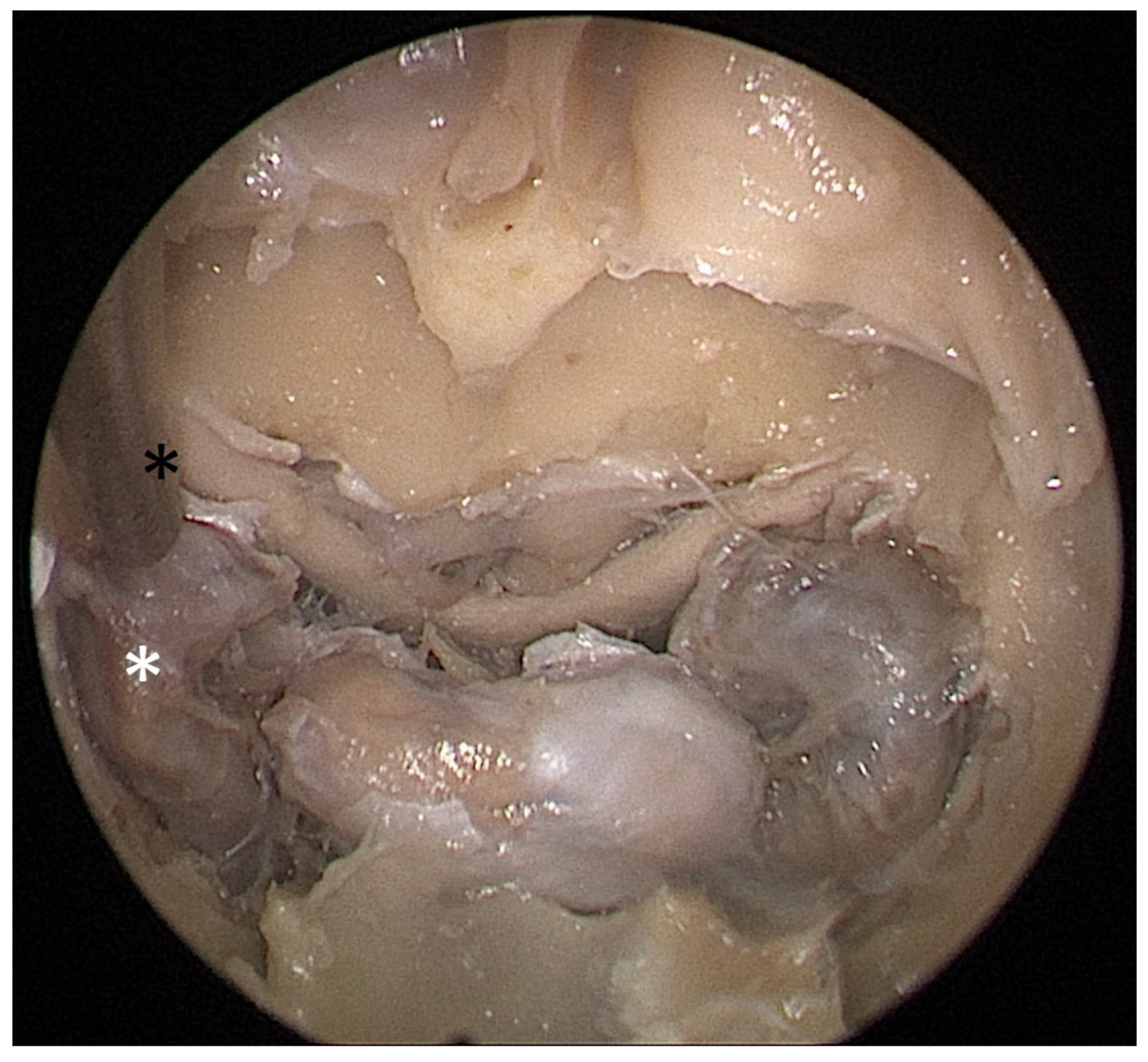 Tomography 09 00172 g006