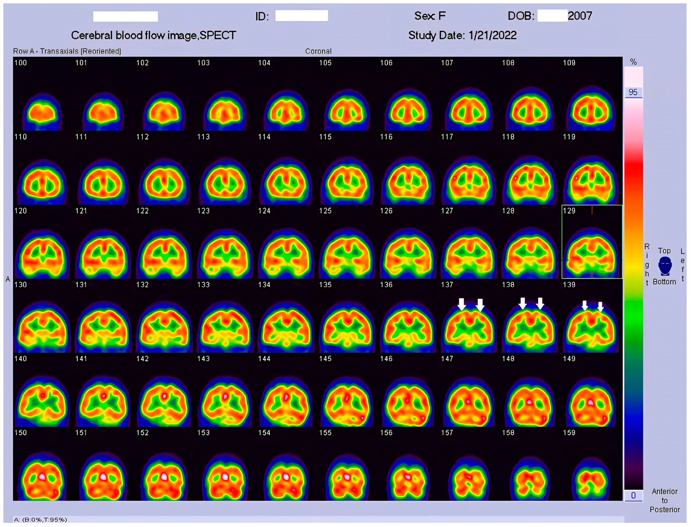 Tomography 09 00175 g004