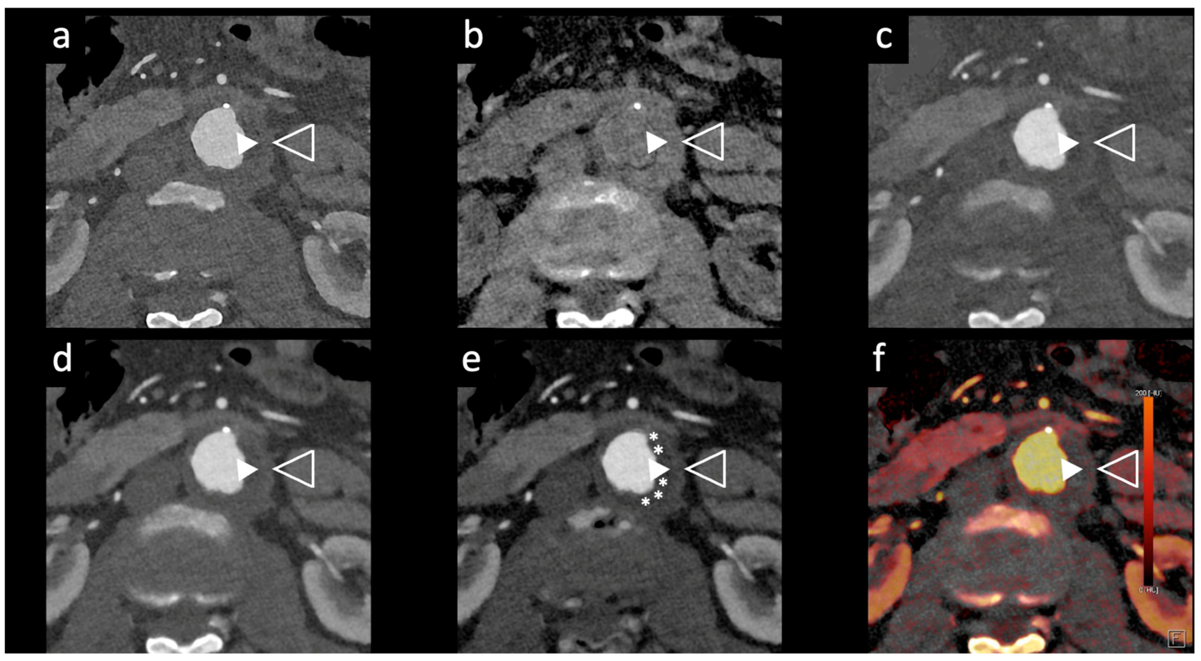 Tomography 10 00001 g002