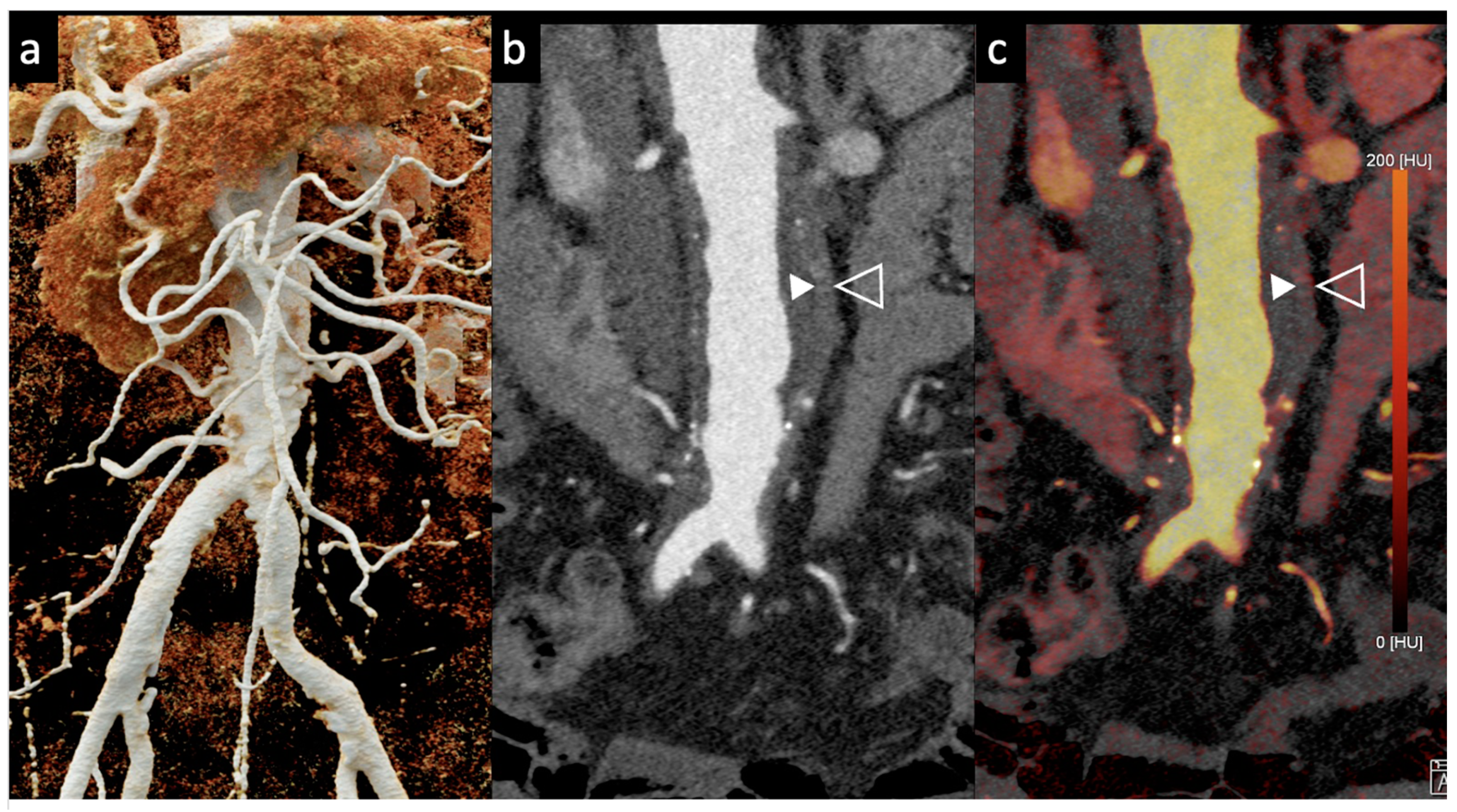 Tomography 10 00001 g005