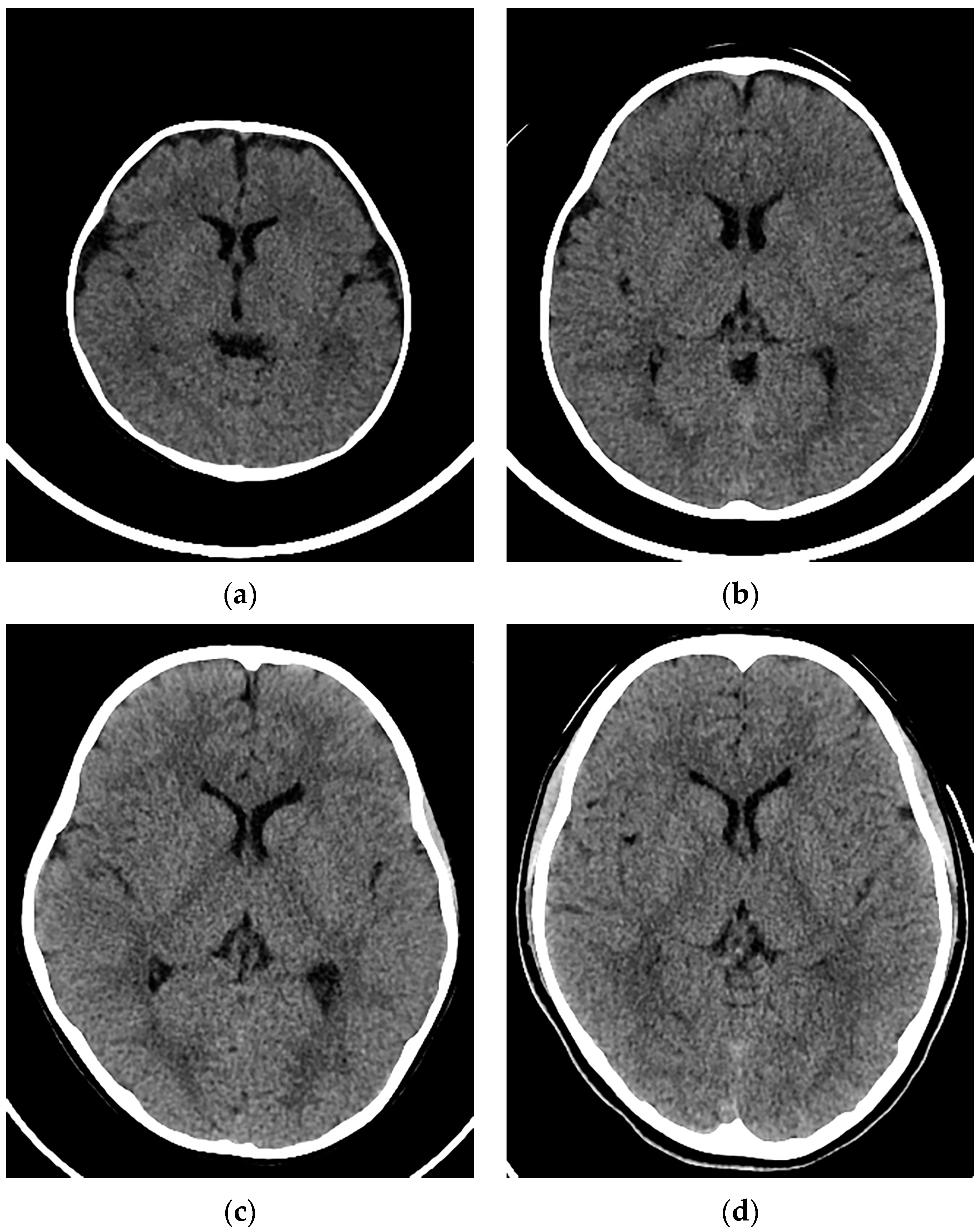 Tomography 10 00002 g002