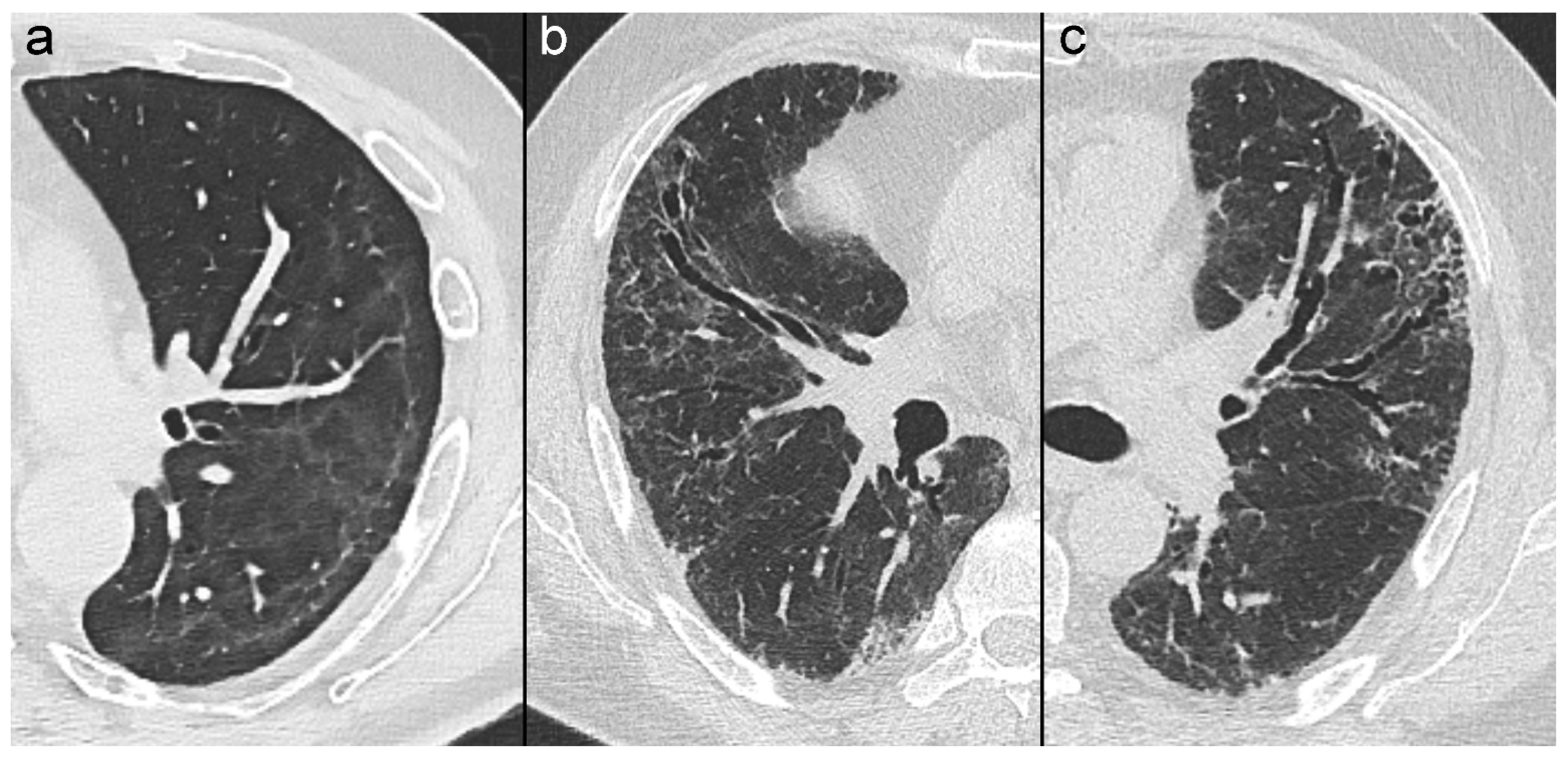 Tomography 10 00003 g001