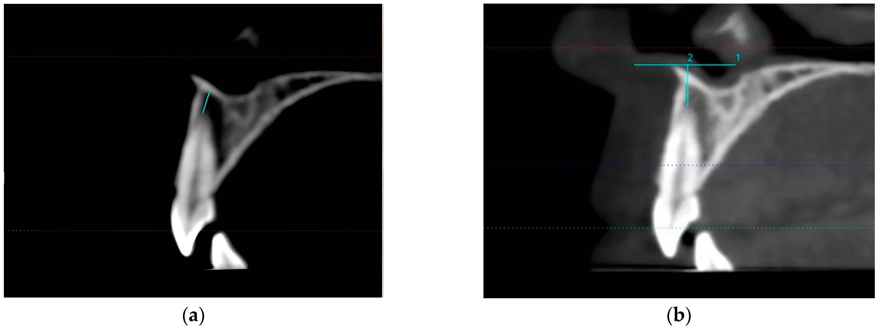 Tomography 10 00004 g002