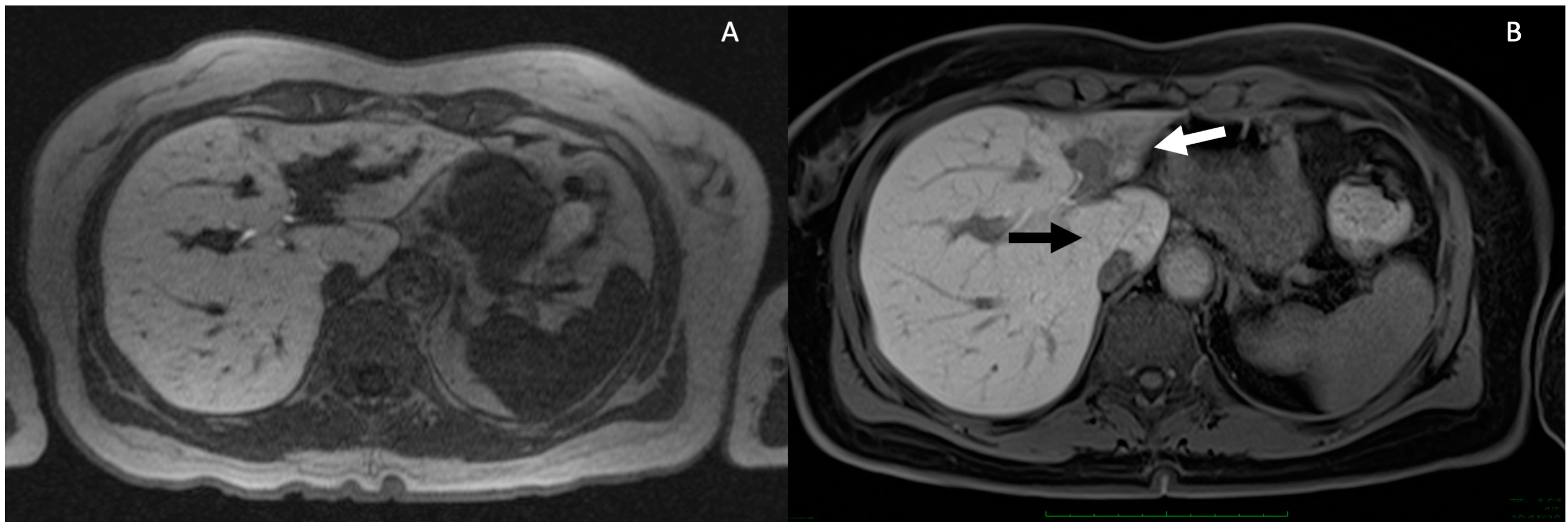 Tomography 10 00005 g004 Tomography 10 00005 g004