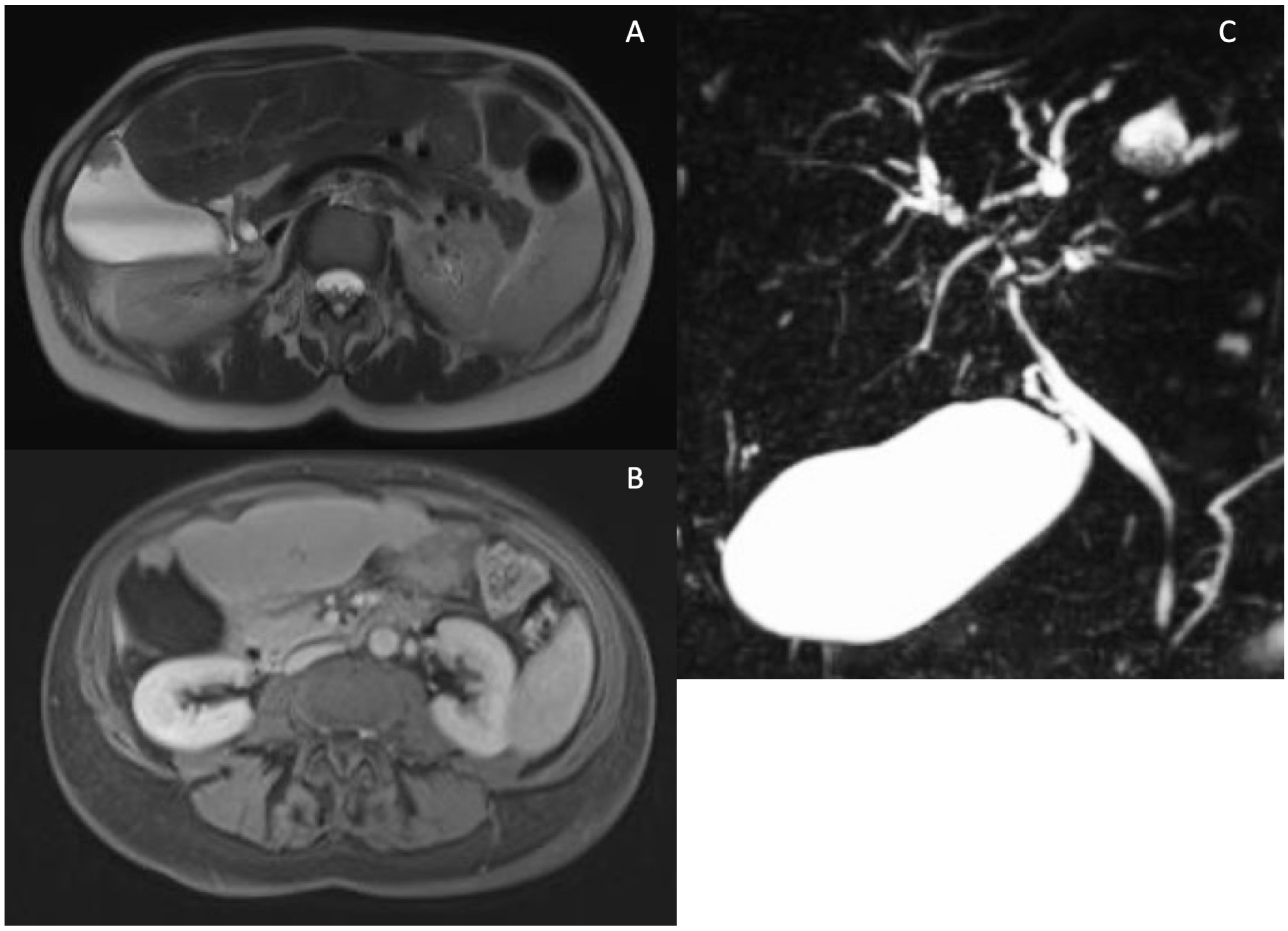 Tomography 10 00005 g006 Tomography 10 00005 g006