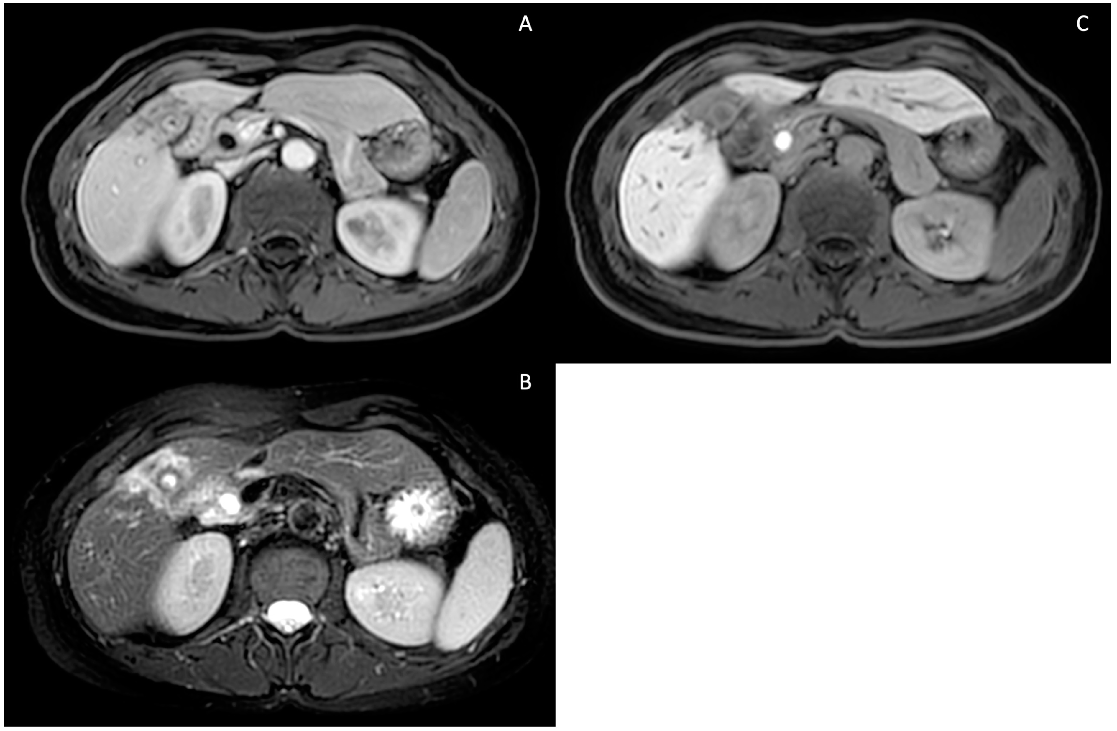 Tomography 10 00005 g007 Tomography 10 00005 g007