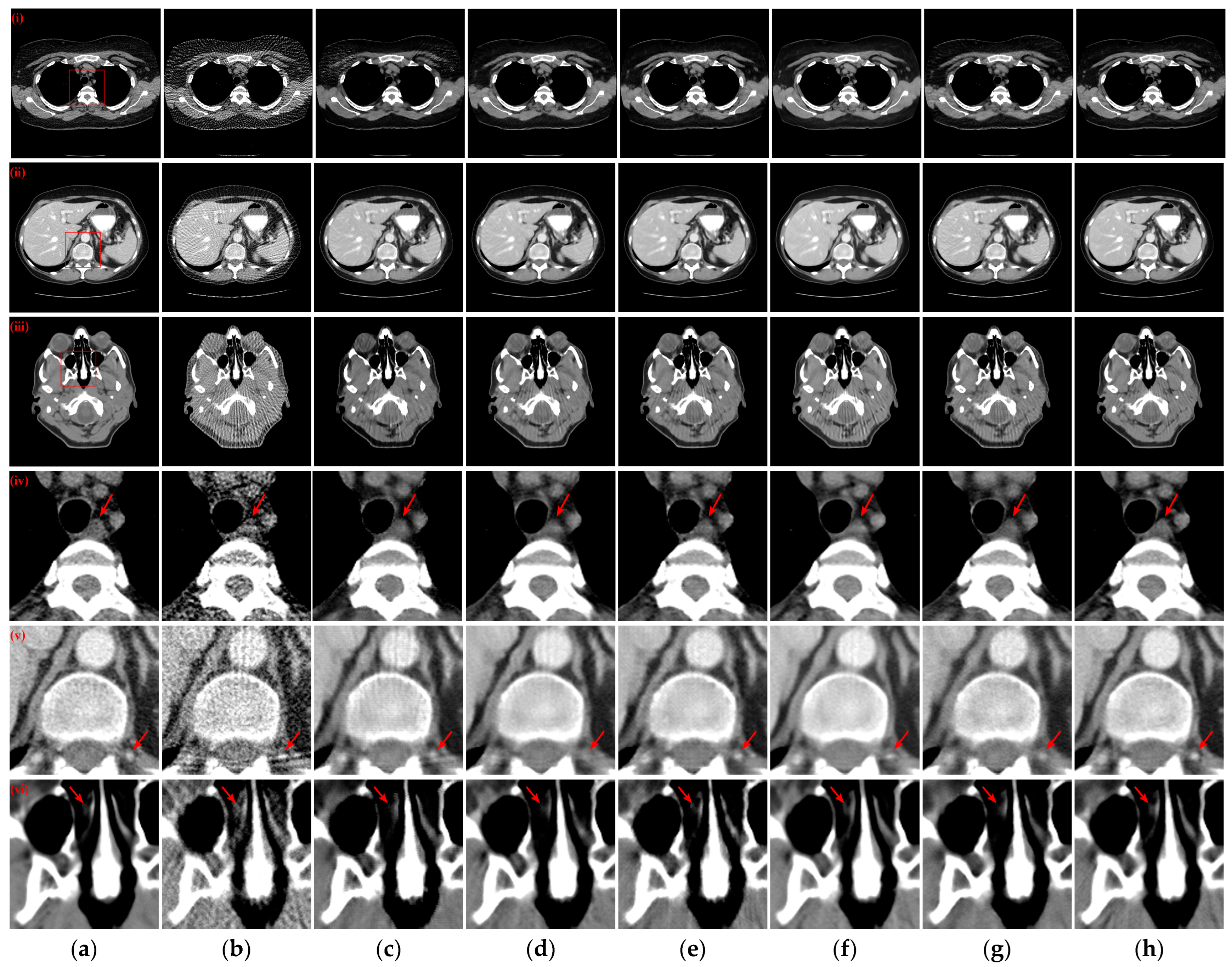 Tomography 10 00011 g004