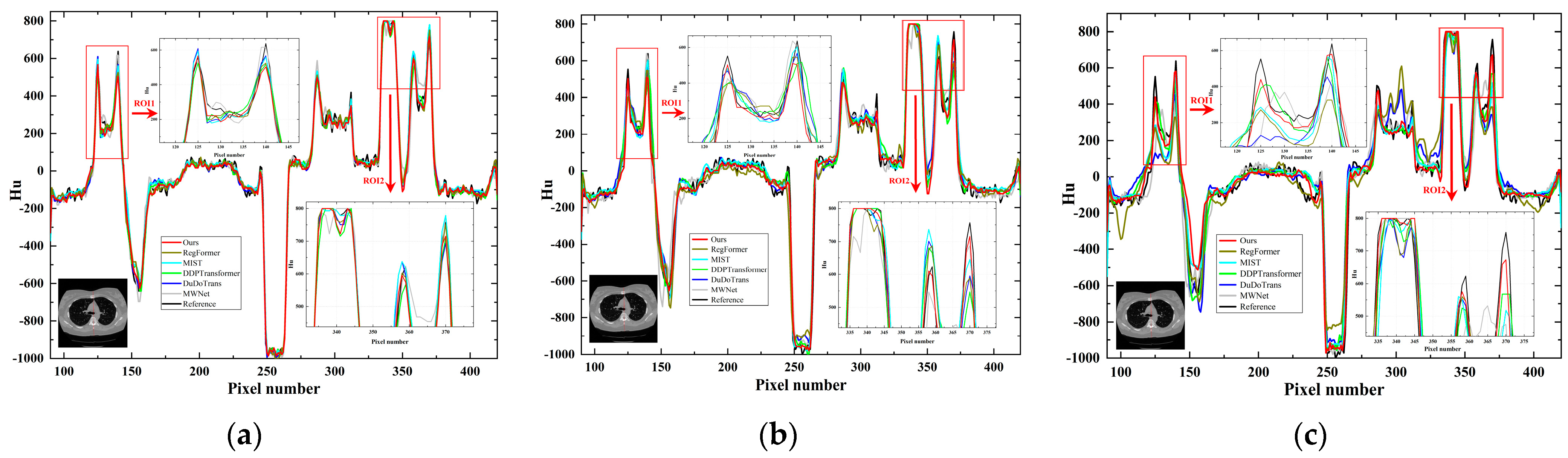 Tomography 10 00011 g008
