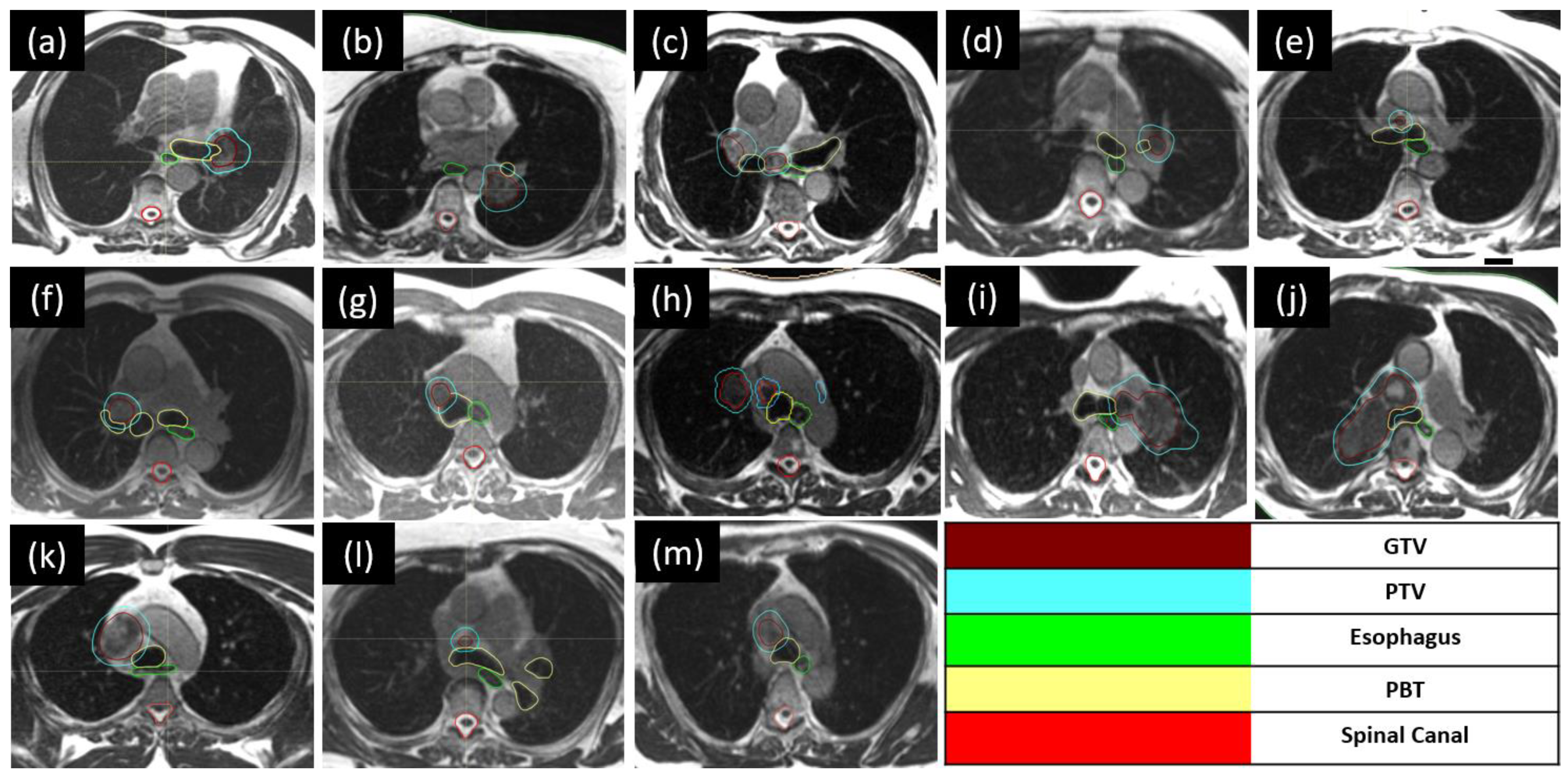 Tomography 10 00013 g001 Tomography 10 00013 g001