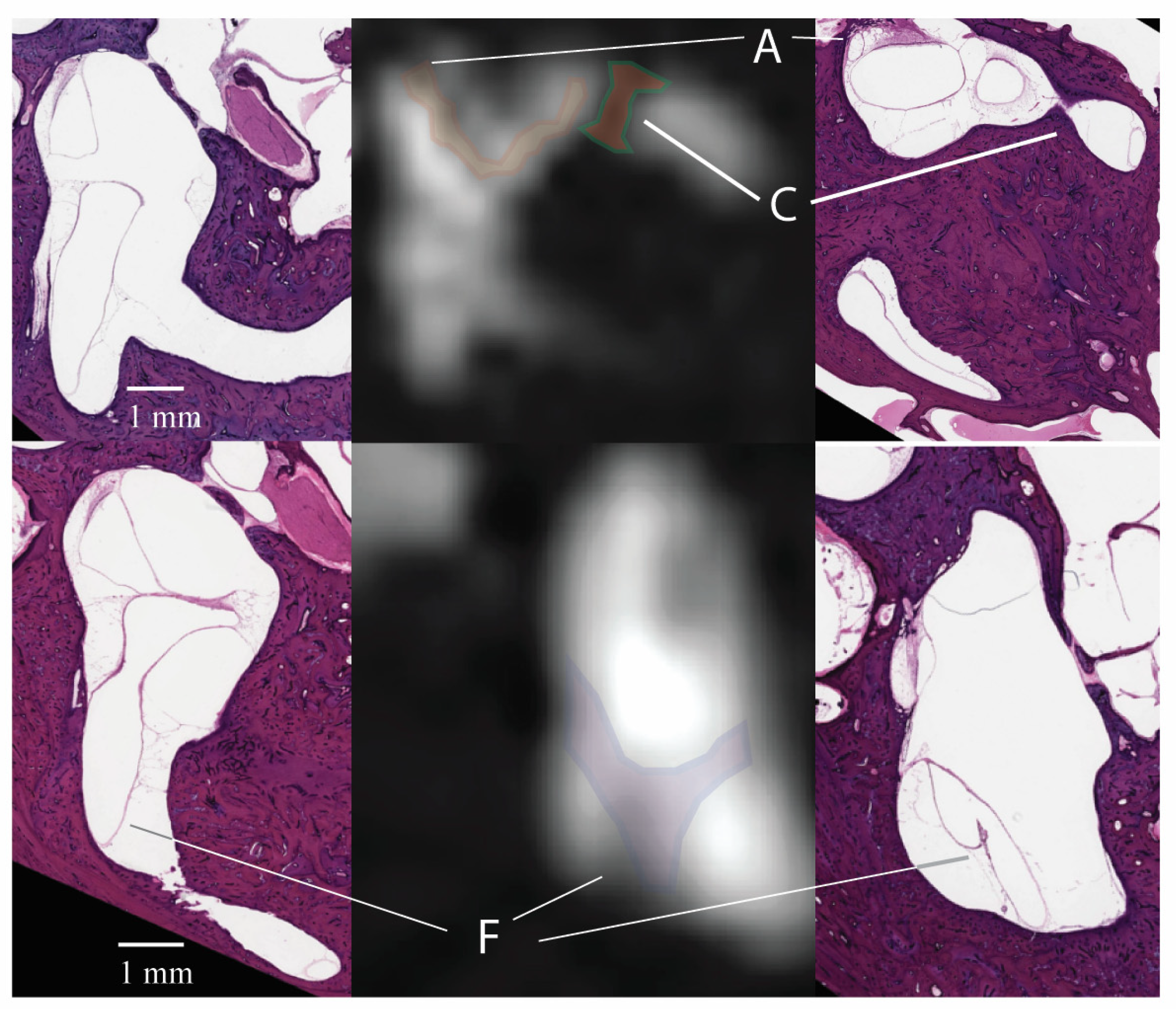Tomography 10 00016 g004 Tomography 10 00016 g004