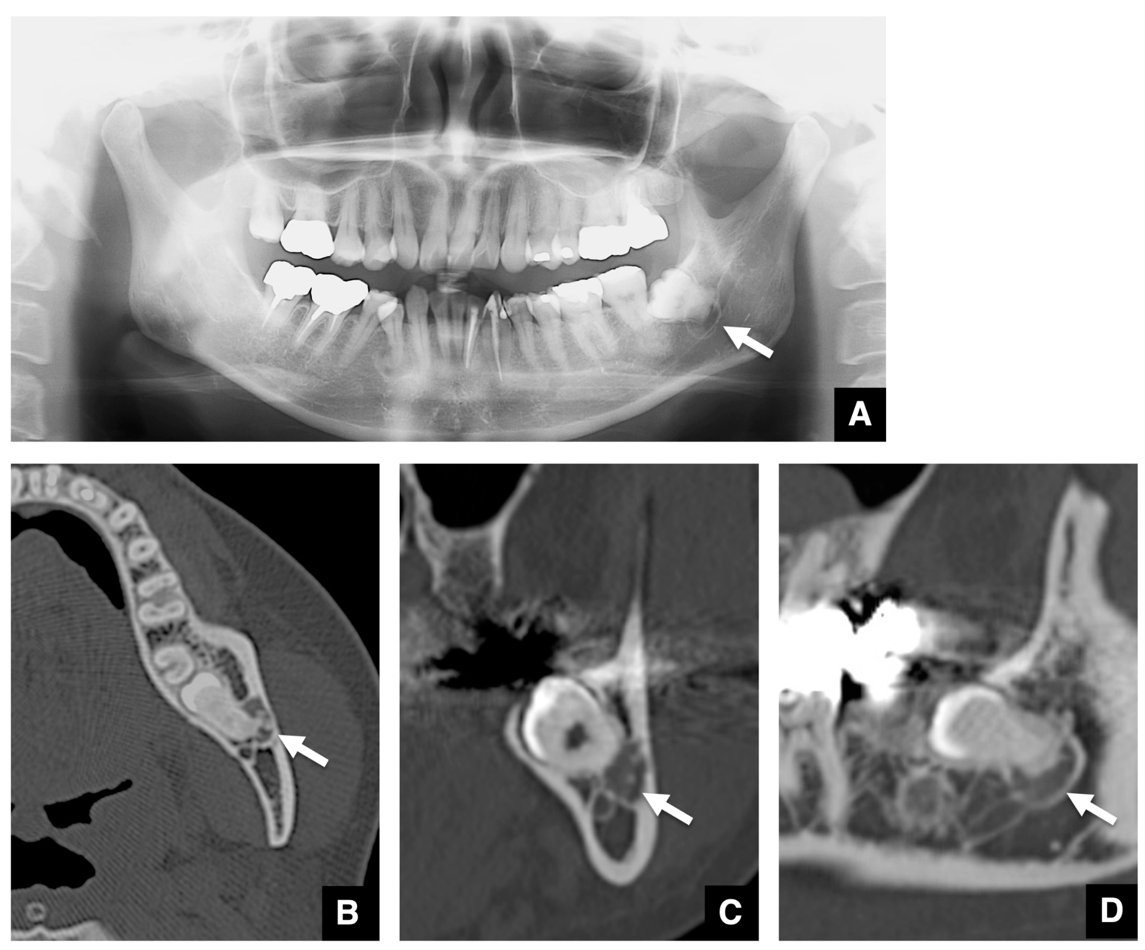 Tomography 10 00018 g002