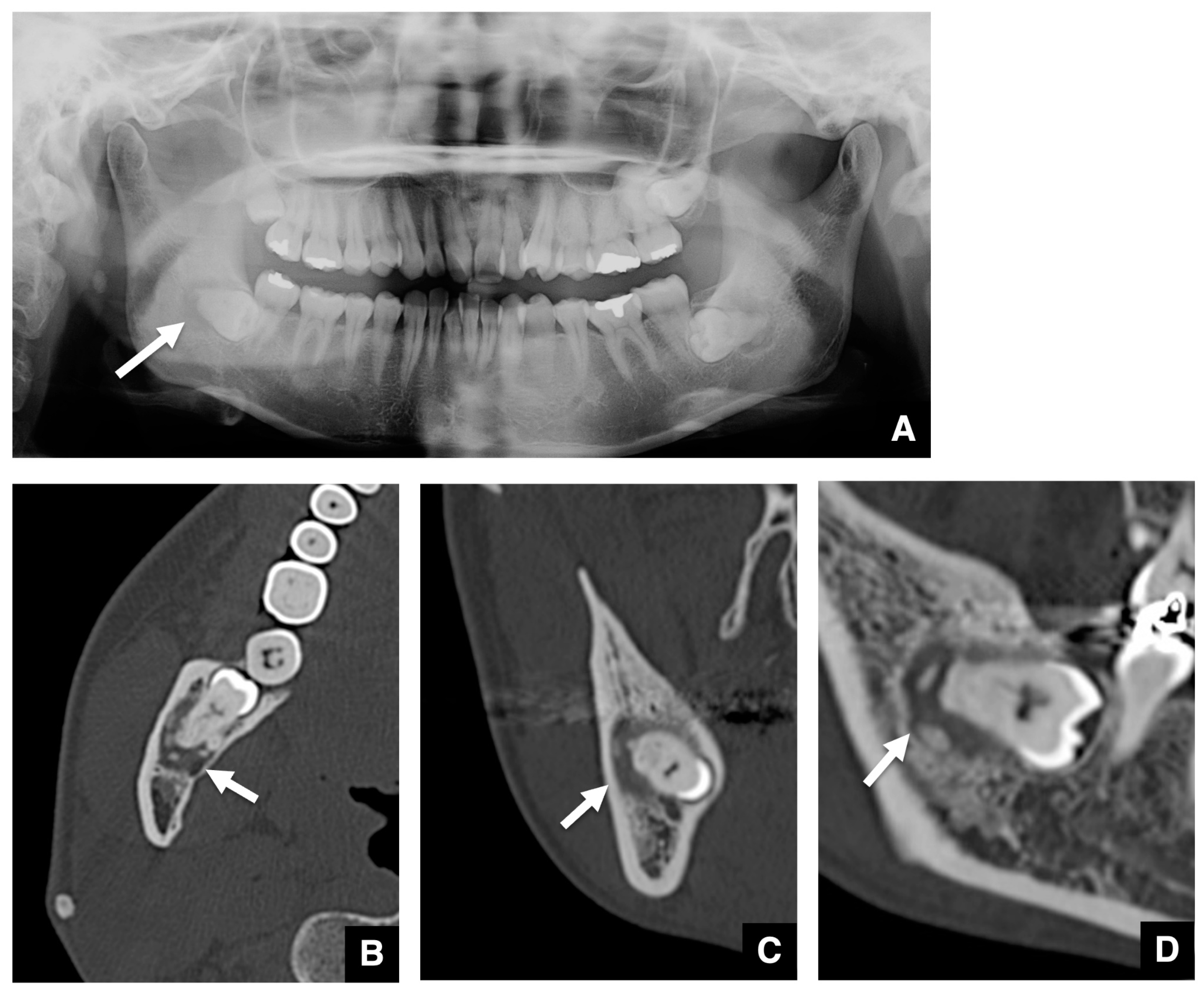 Tomography 10 00018 g003