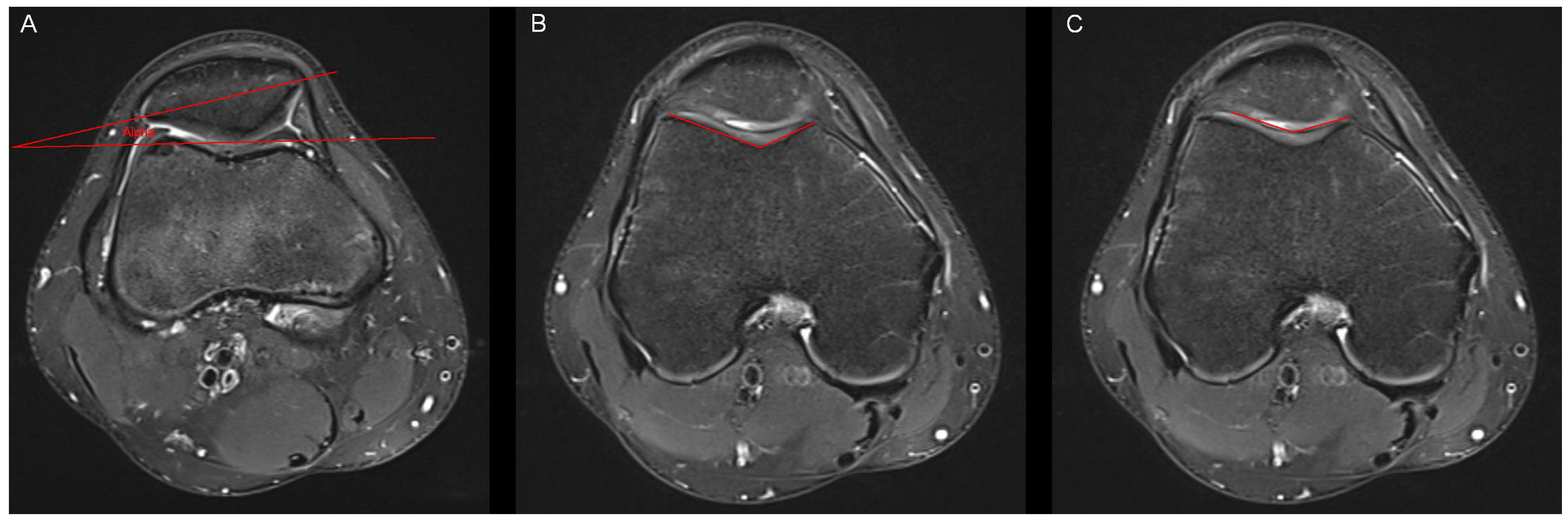 Tomography 10 00019 g002