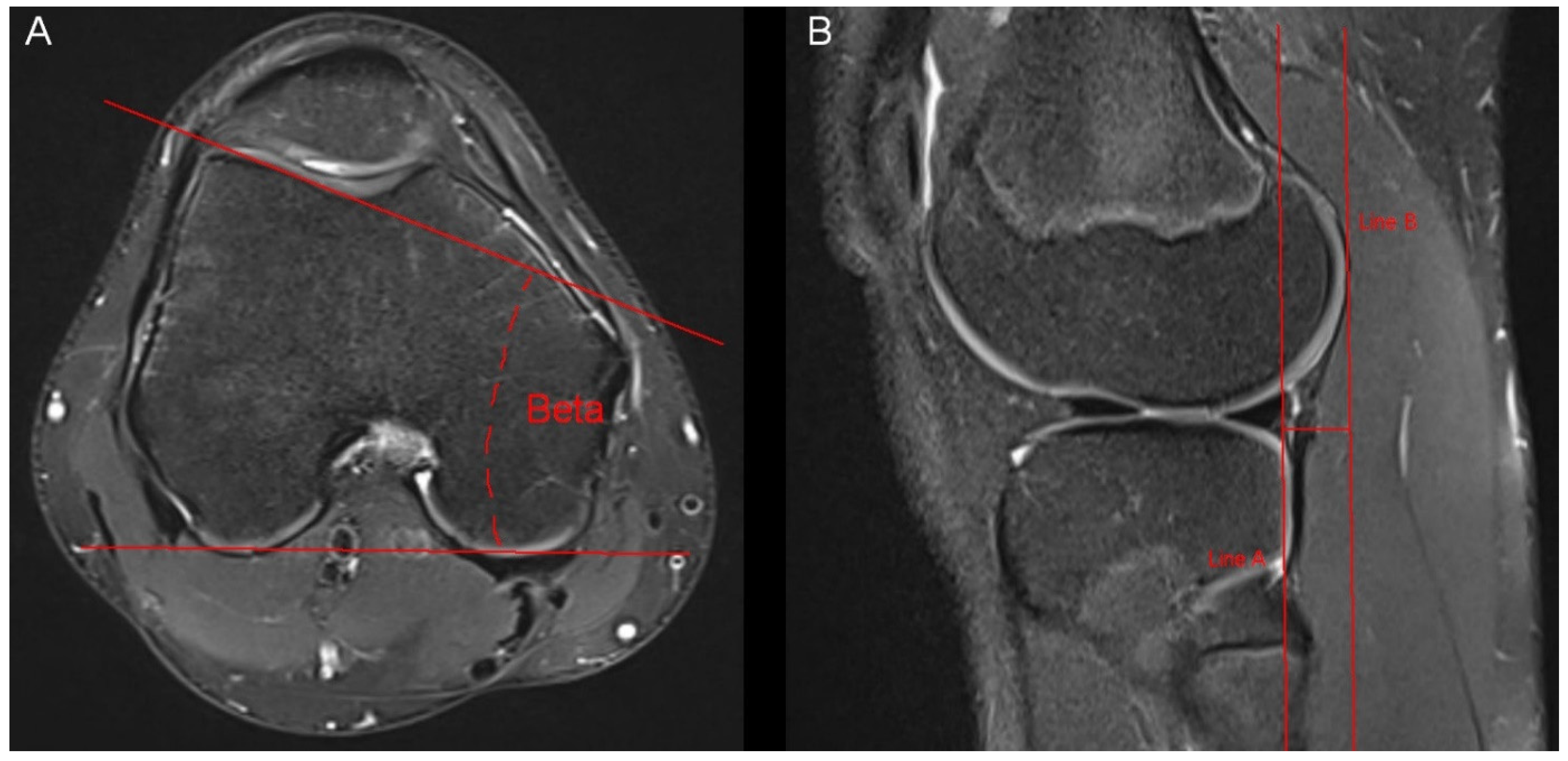 Tomography 10 00019 g003