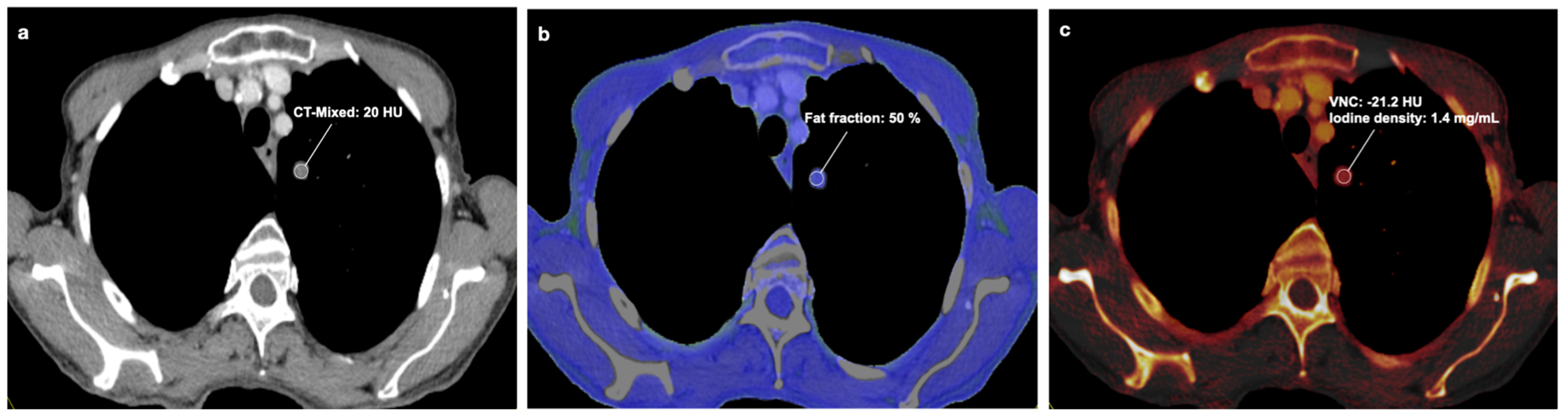 Tomography 10 00020 g003