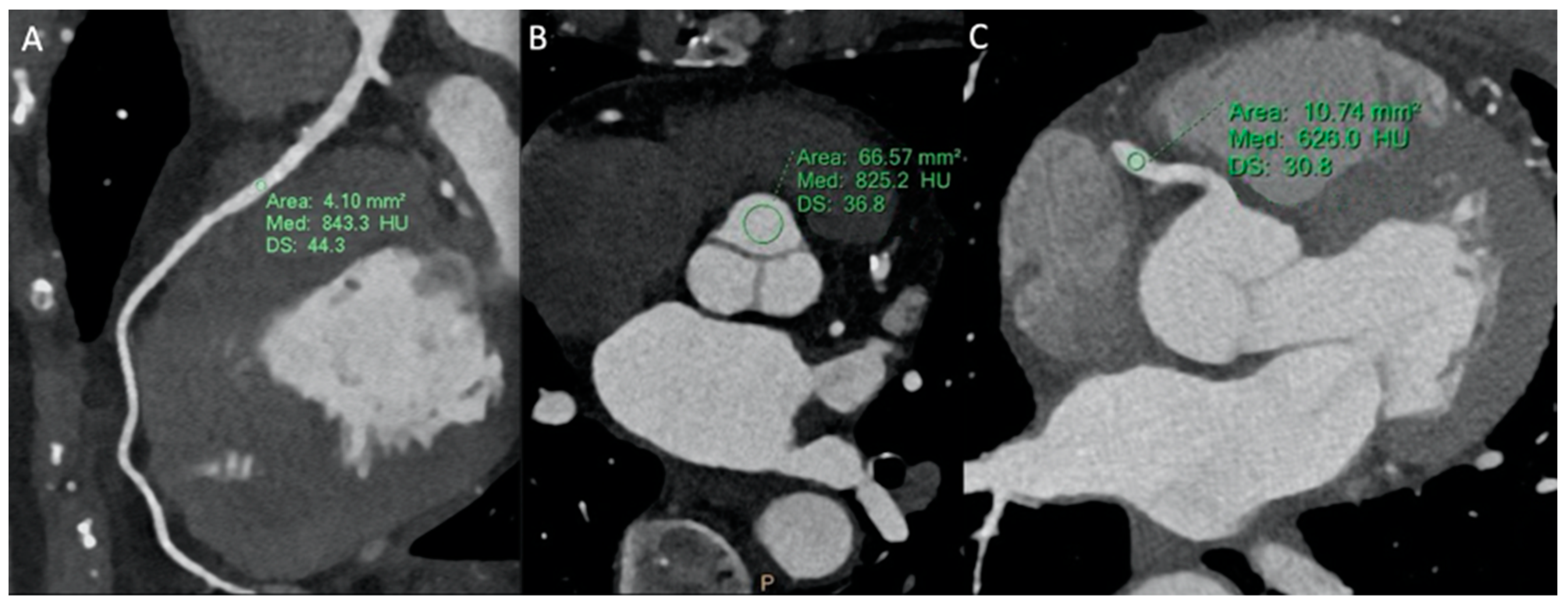 Tomography 10 00023 g002 Tomography 10 00023 g002