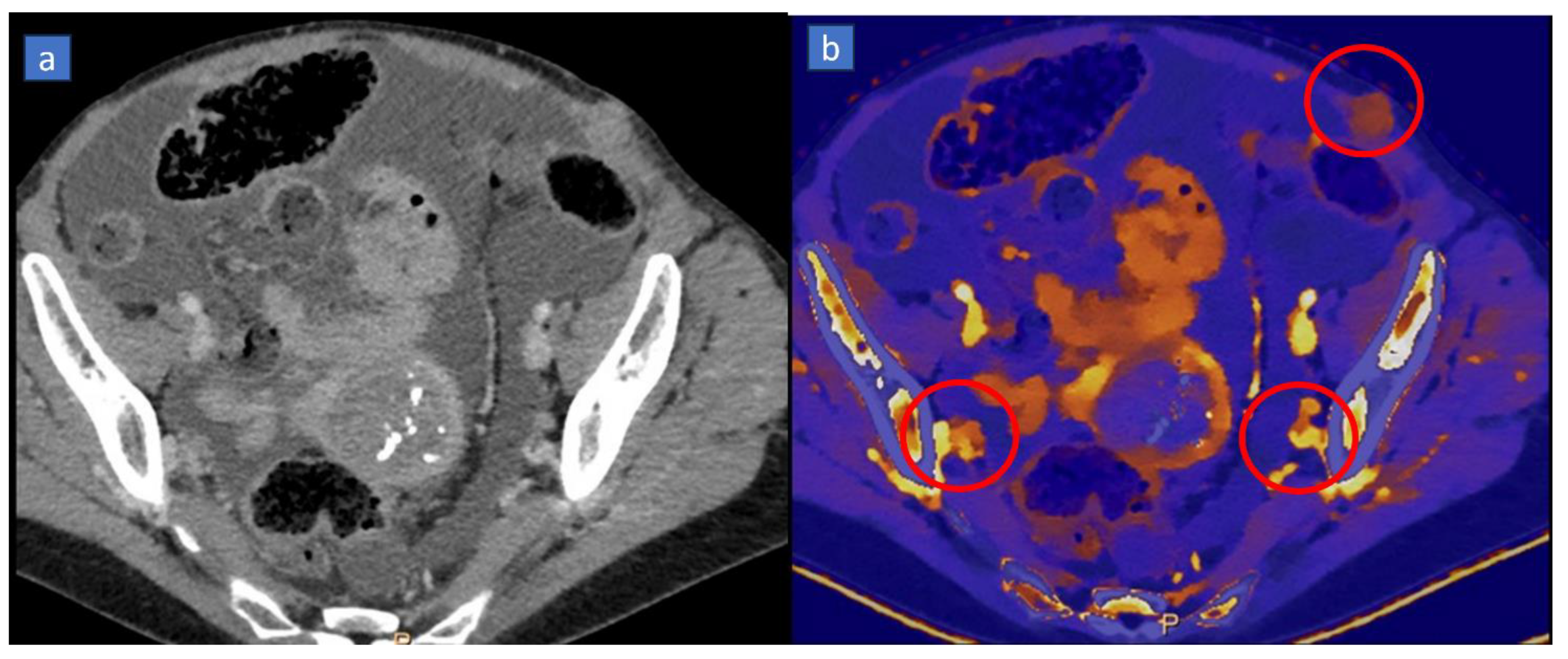 Tomography 10 00024 g006