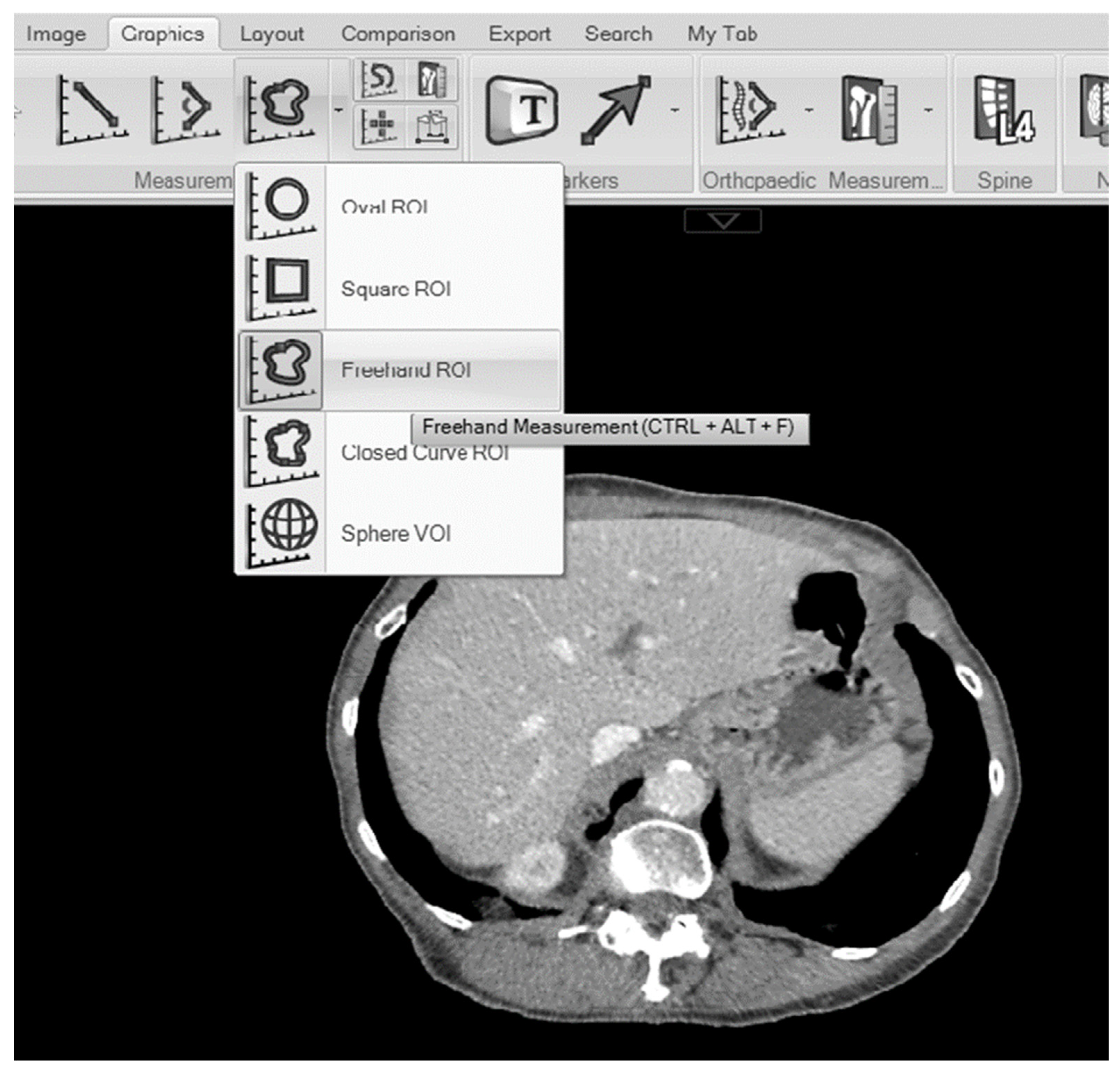 Tomography 10 00027 g001