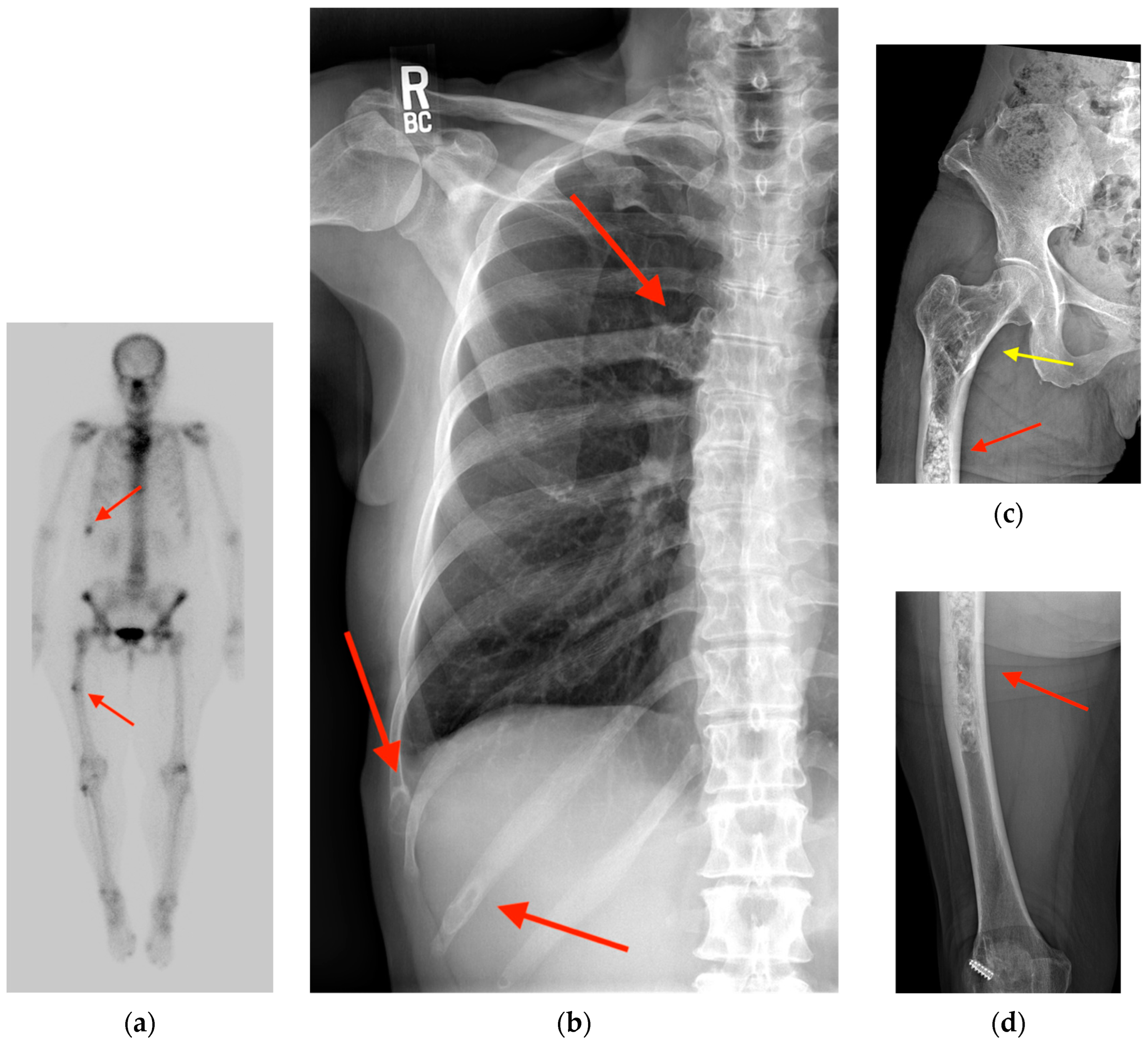Tomography 10 00030 g003