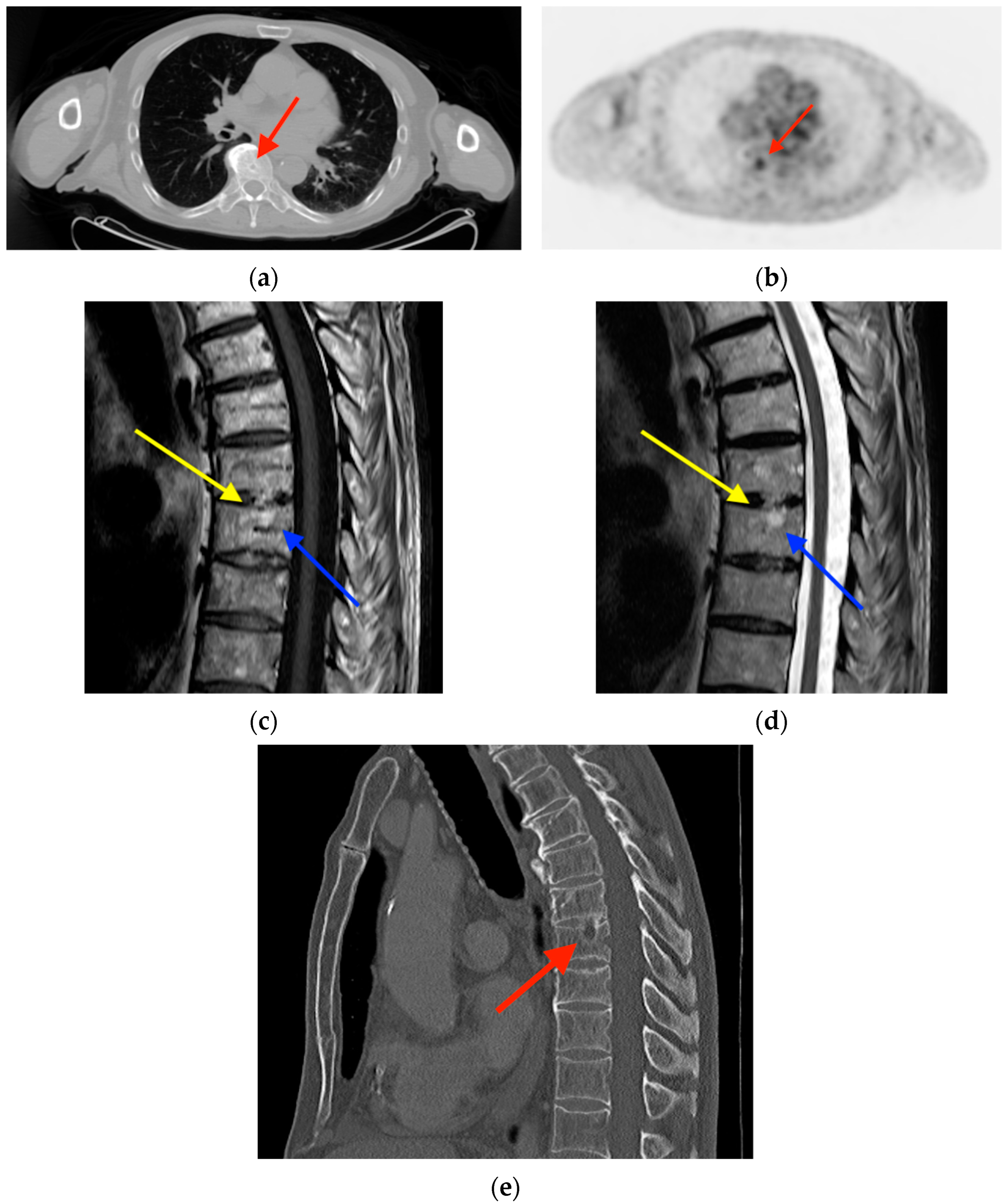 Tomography 10 00030 g005