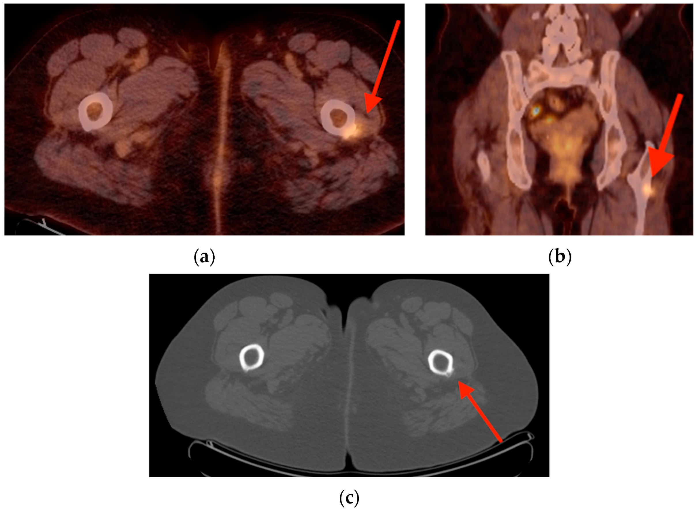 Tomography 10 00030 g009
