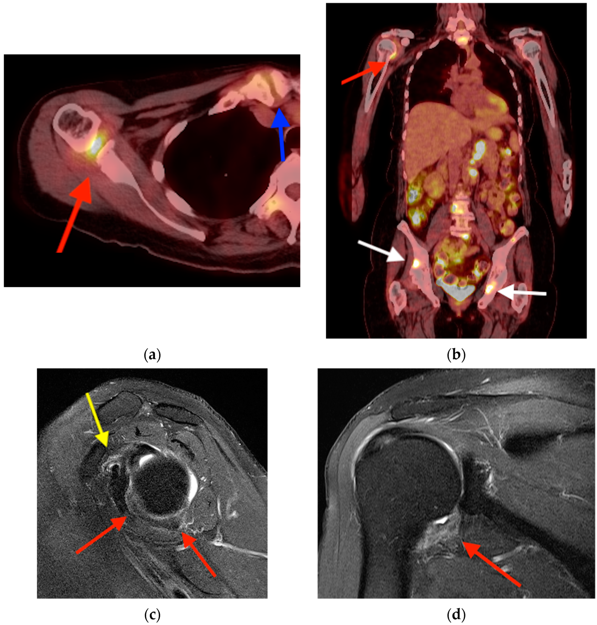 Tomography 10 00030 g013