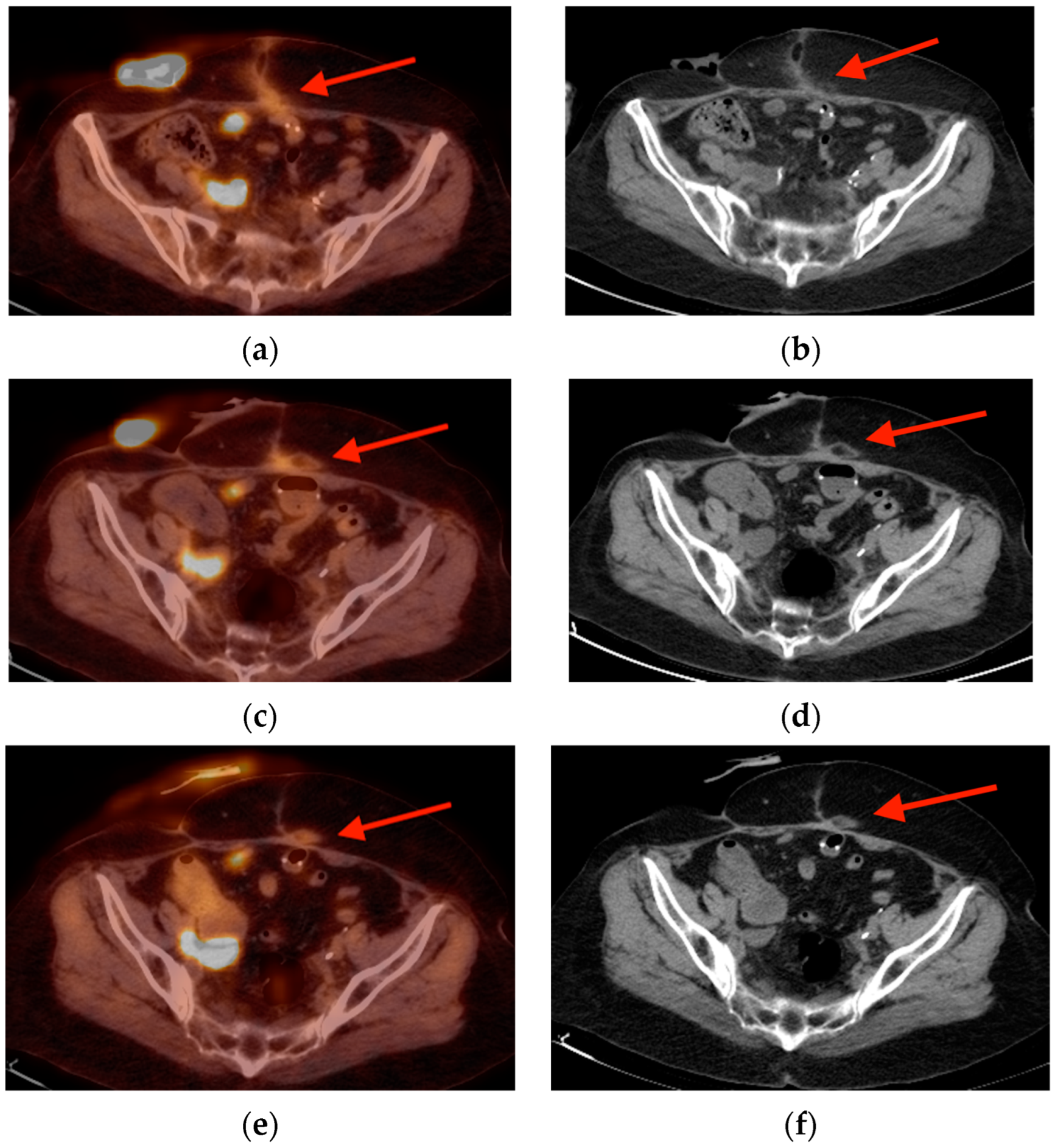 Tomography 10 00030 g015