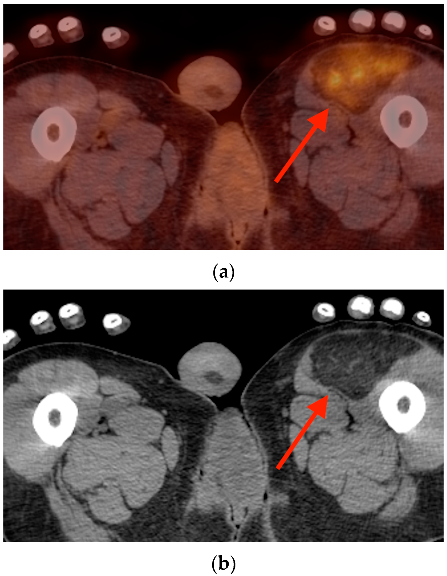 Tomography 10 00030 g017