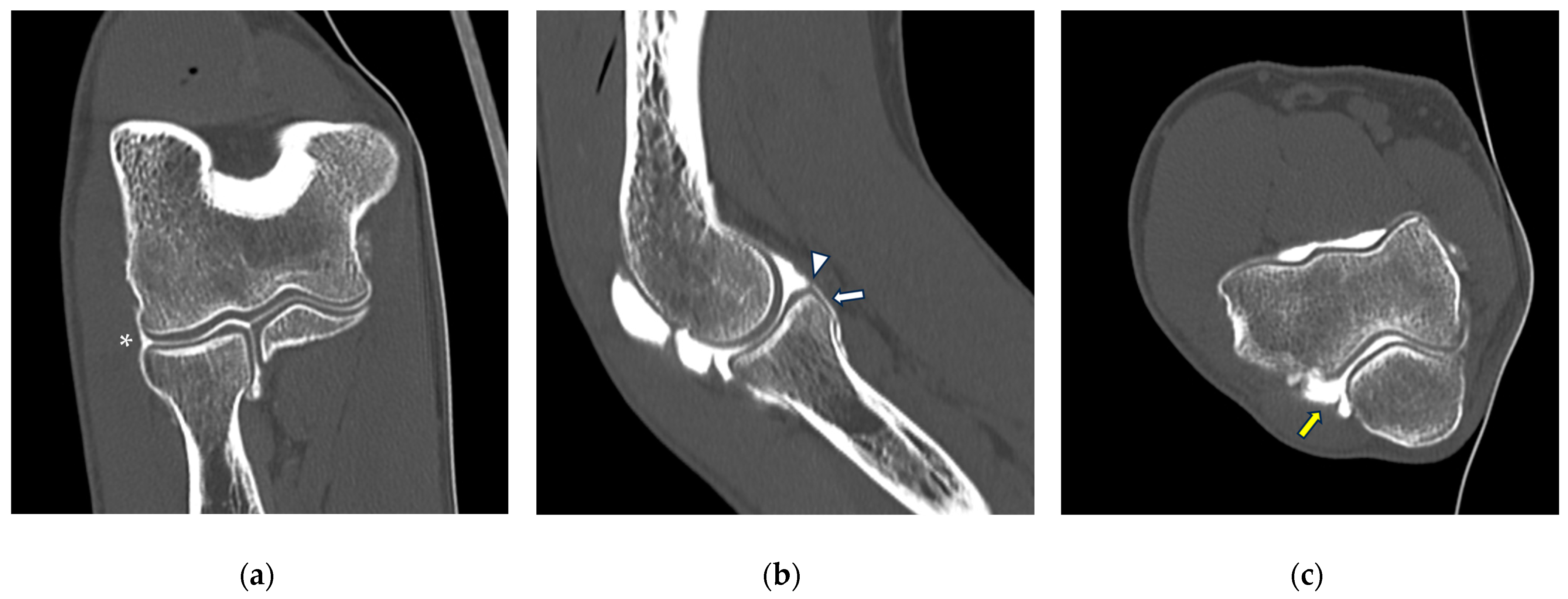 Tomography 10 00032 g002