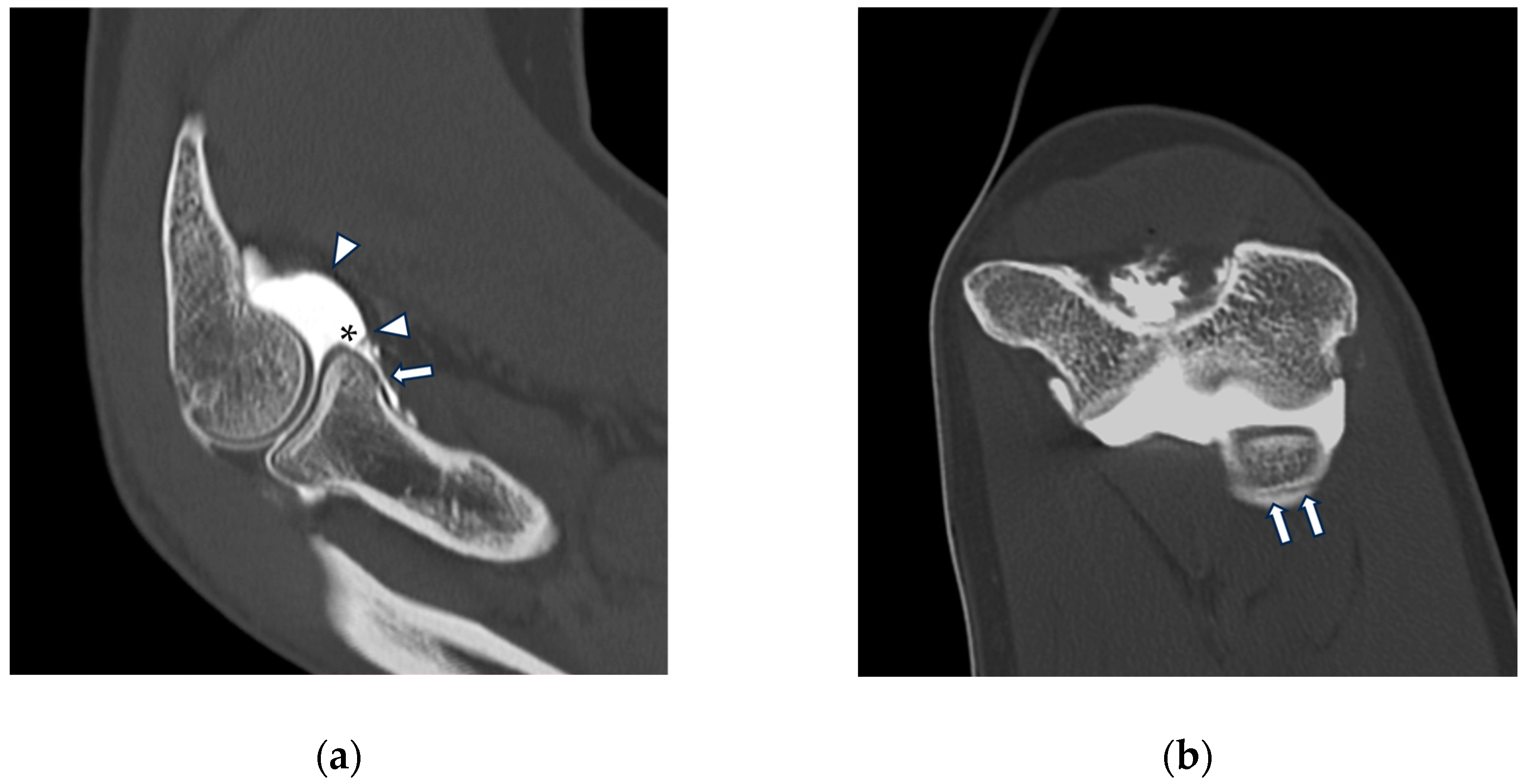 Tomography 10 00032 g007