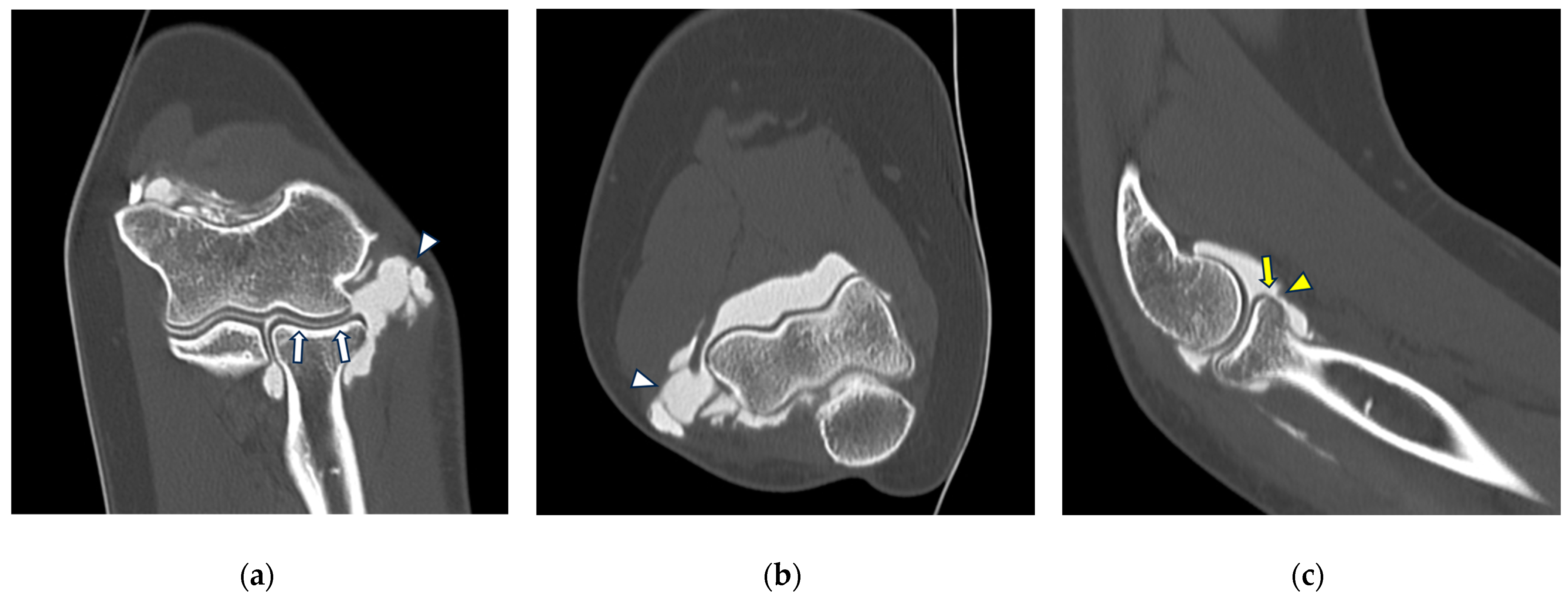 Tomography 10 00032 g008