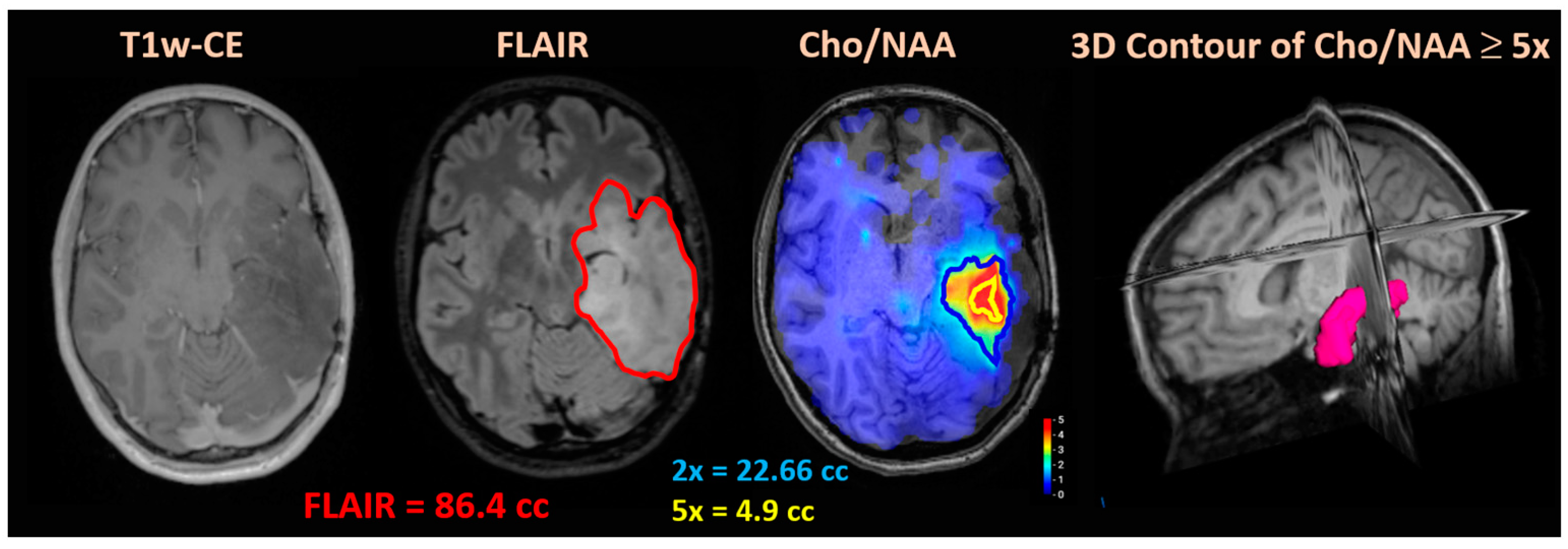 Tomography 10 00033 g002