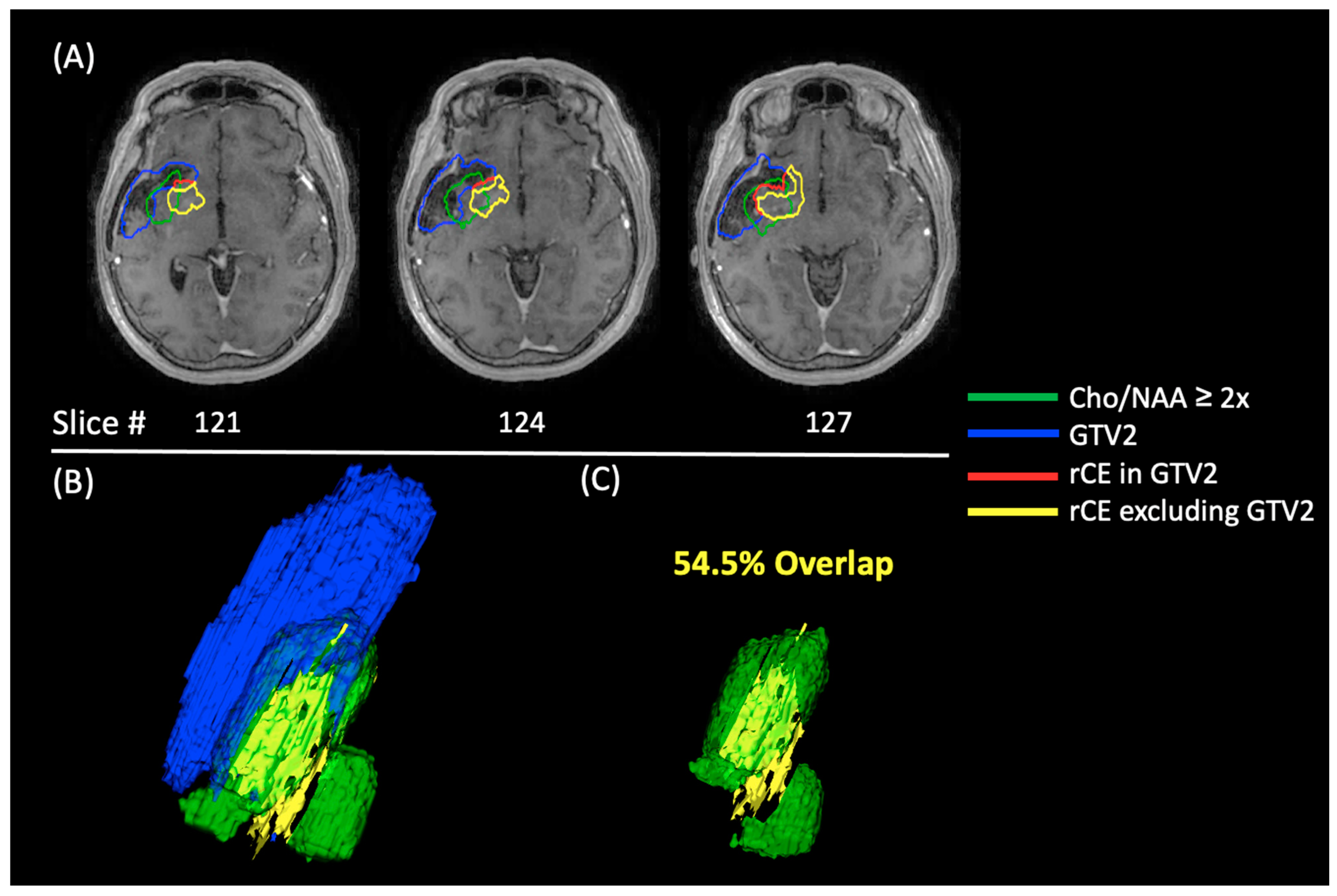Tomography 10 00033 g008