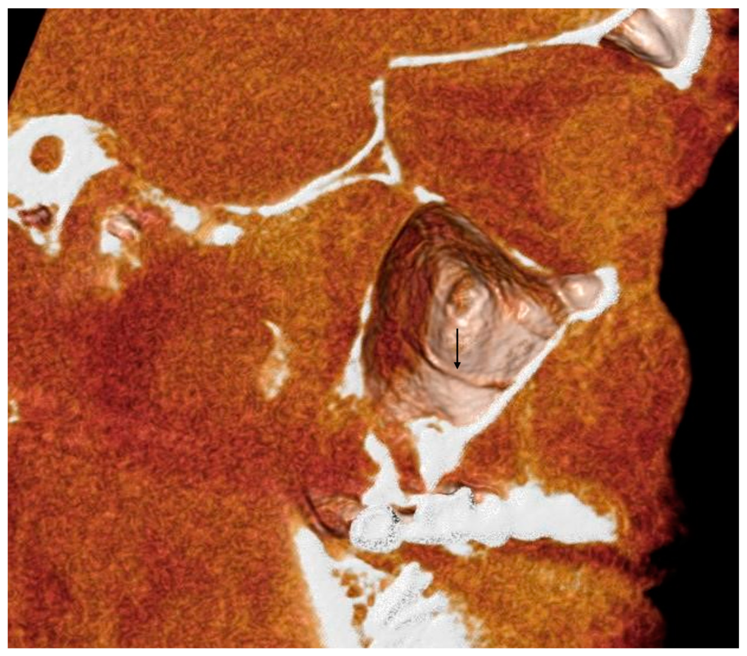 Tomography 10 00034 g005