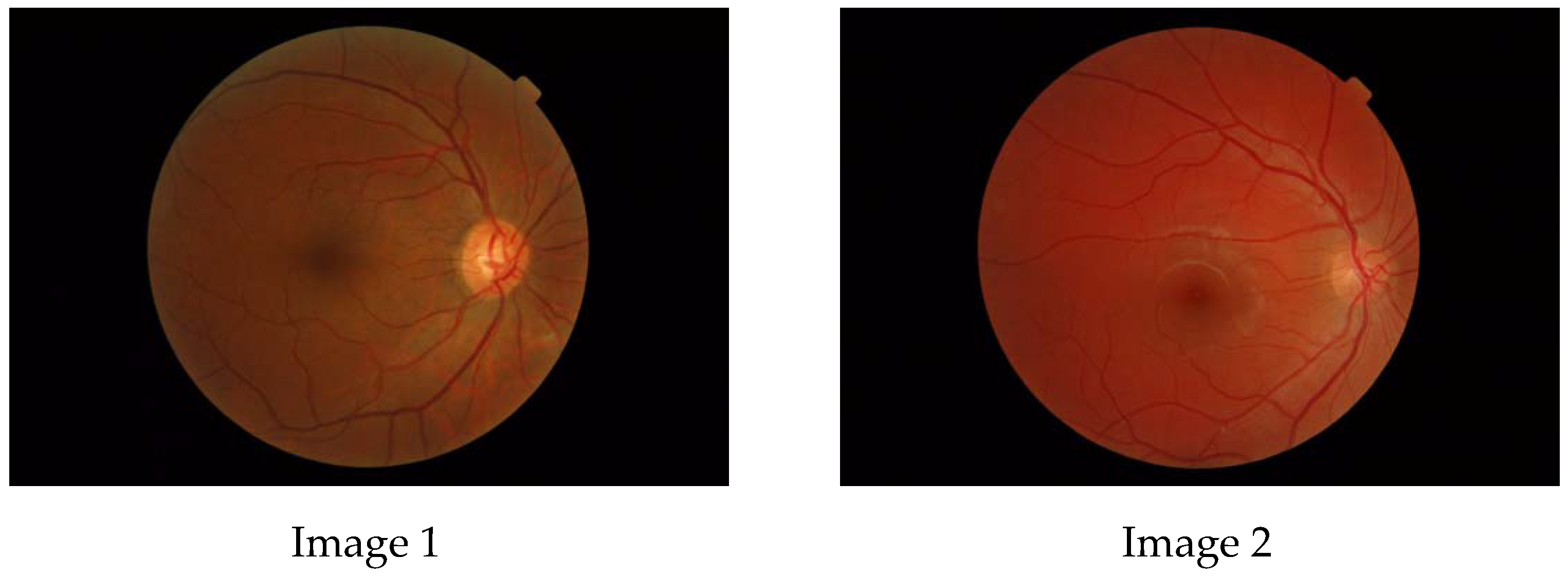 Tomography 10 00037 g001